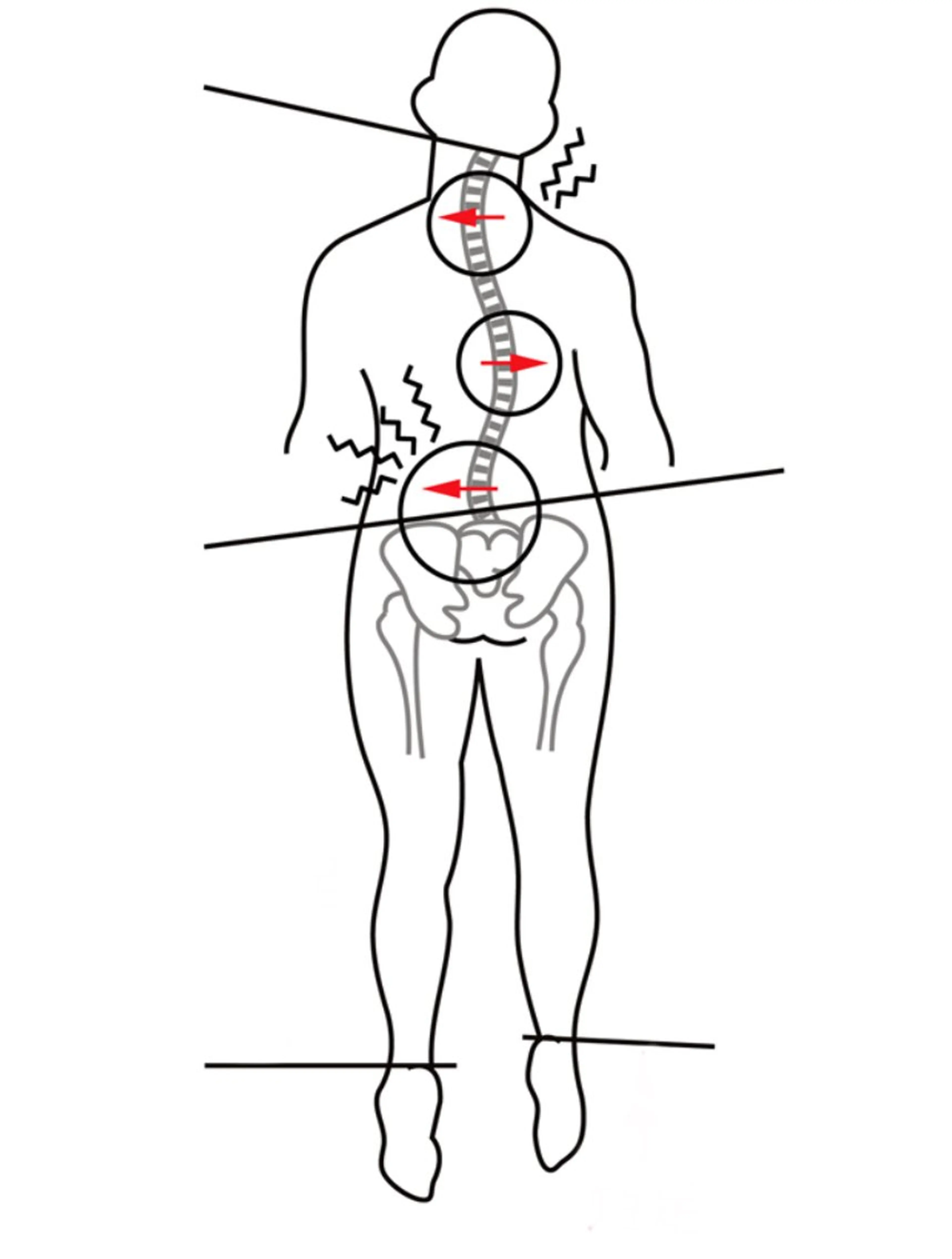 「2回目クーポン」身体の歪みを改善🧚‍♀️💫の写真