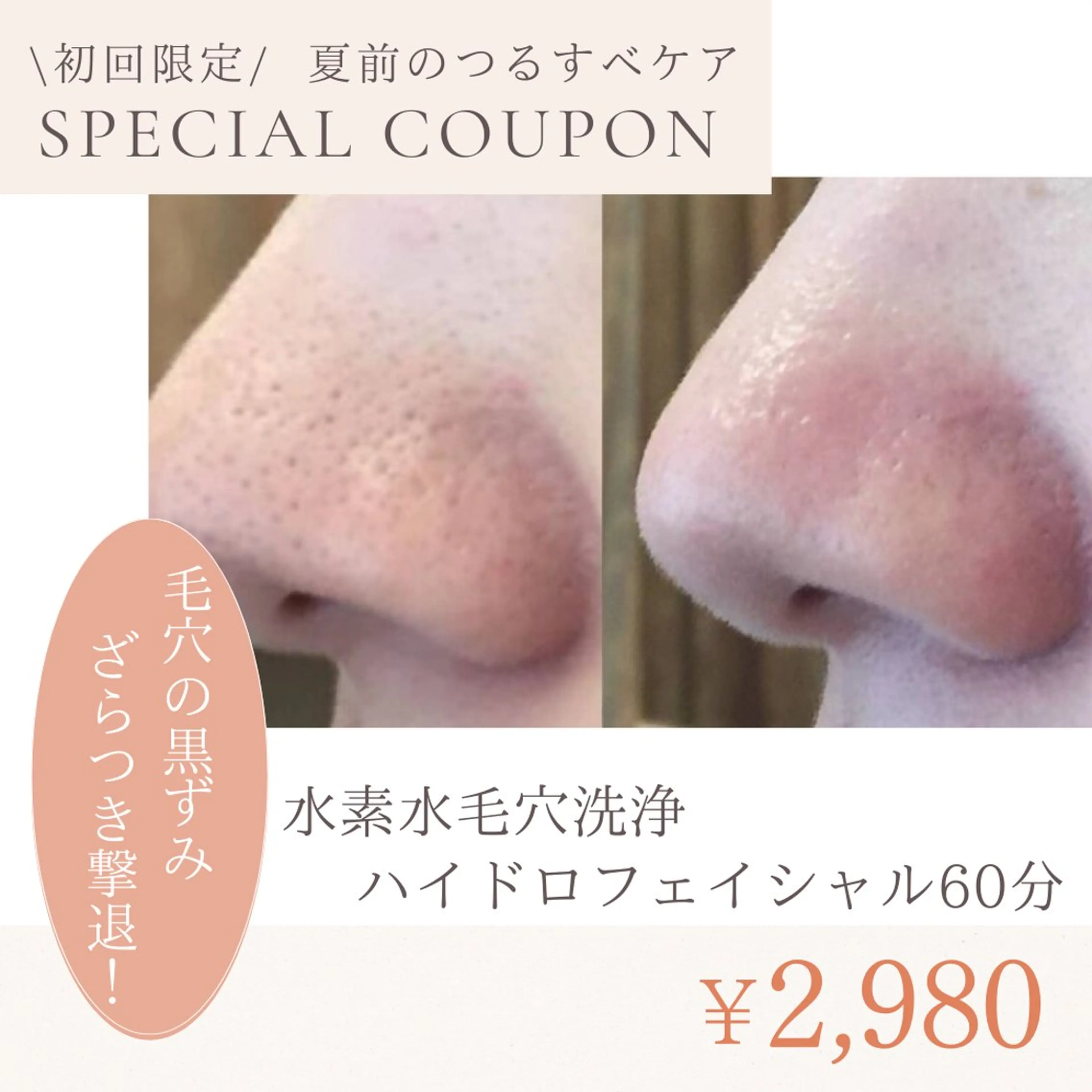 🫧ハイドロフェイシャル毛穴洗浄《ざらつき、毛穴詰まりも綺麗に✨️》の写真