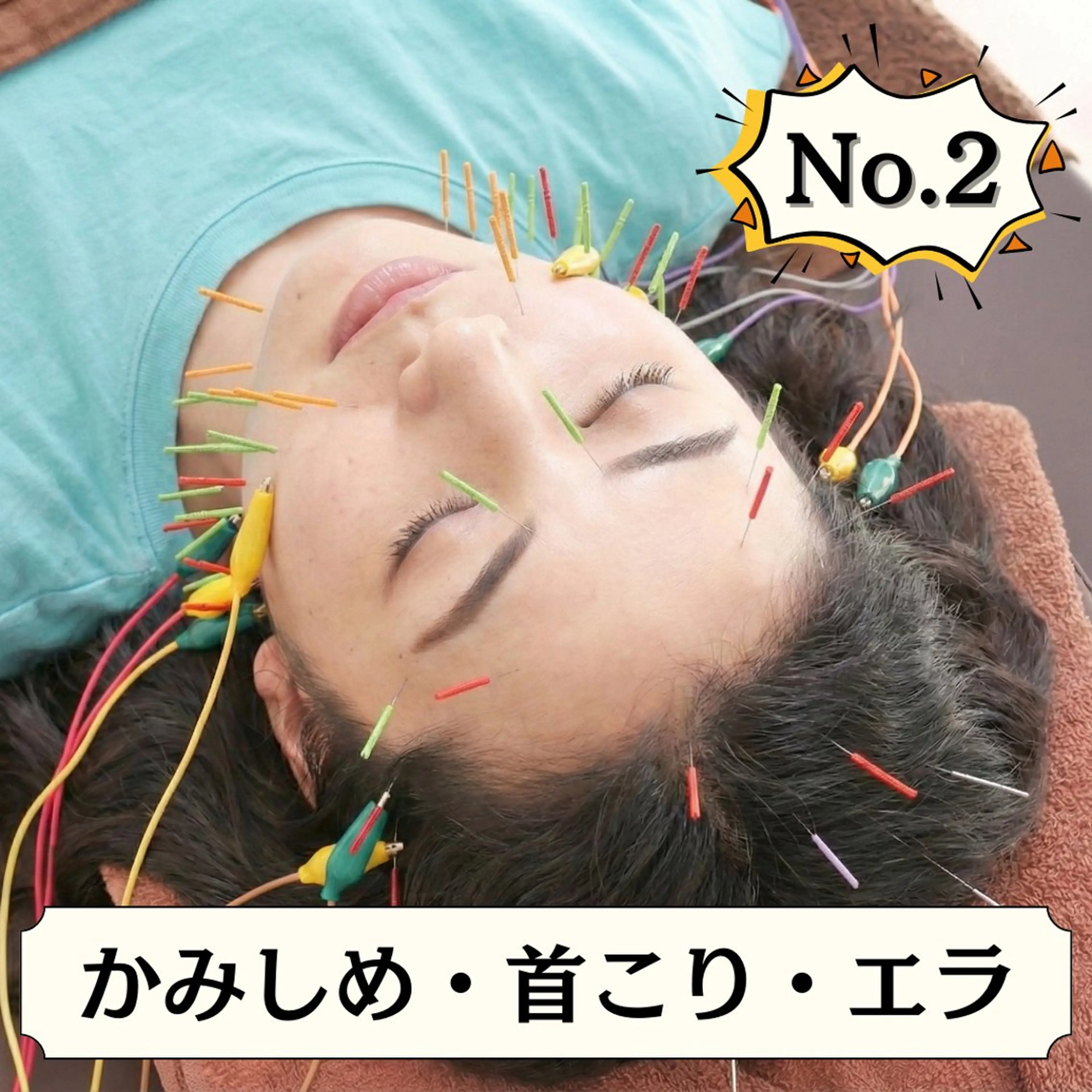 【4月限定☆小顔】美容鍼＋首マッサージ＋ヘッドスパ　¥12,000→￥5,980の写真