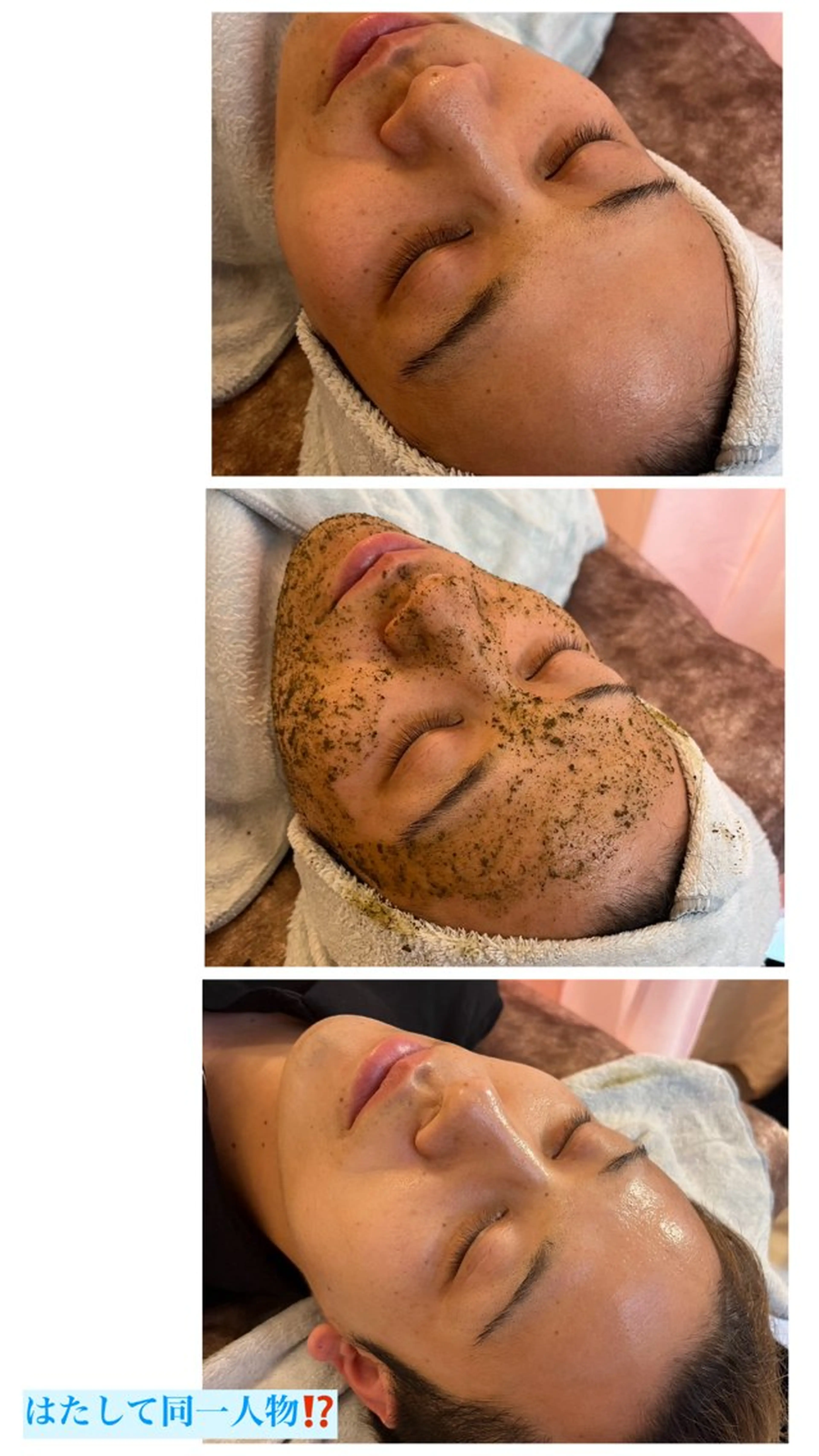 ハーブピーリング/韓国肌管理/フェイシャル/毛穴洗浄/眉毛/顔脱毛【糸脱毛専門】rev所属・ハーブピーリング専門 毛穴洗浄❤️眉waxのエステ・リラクイメージ