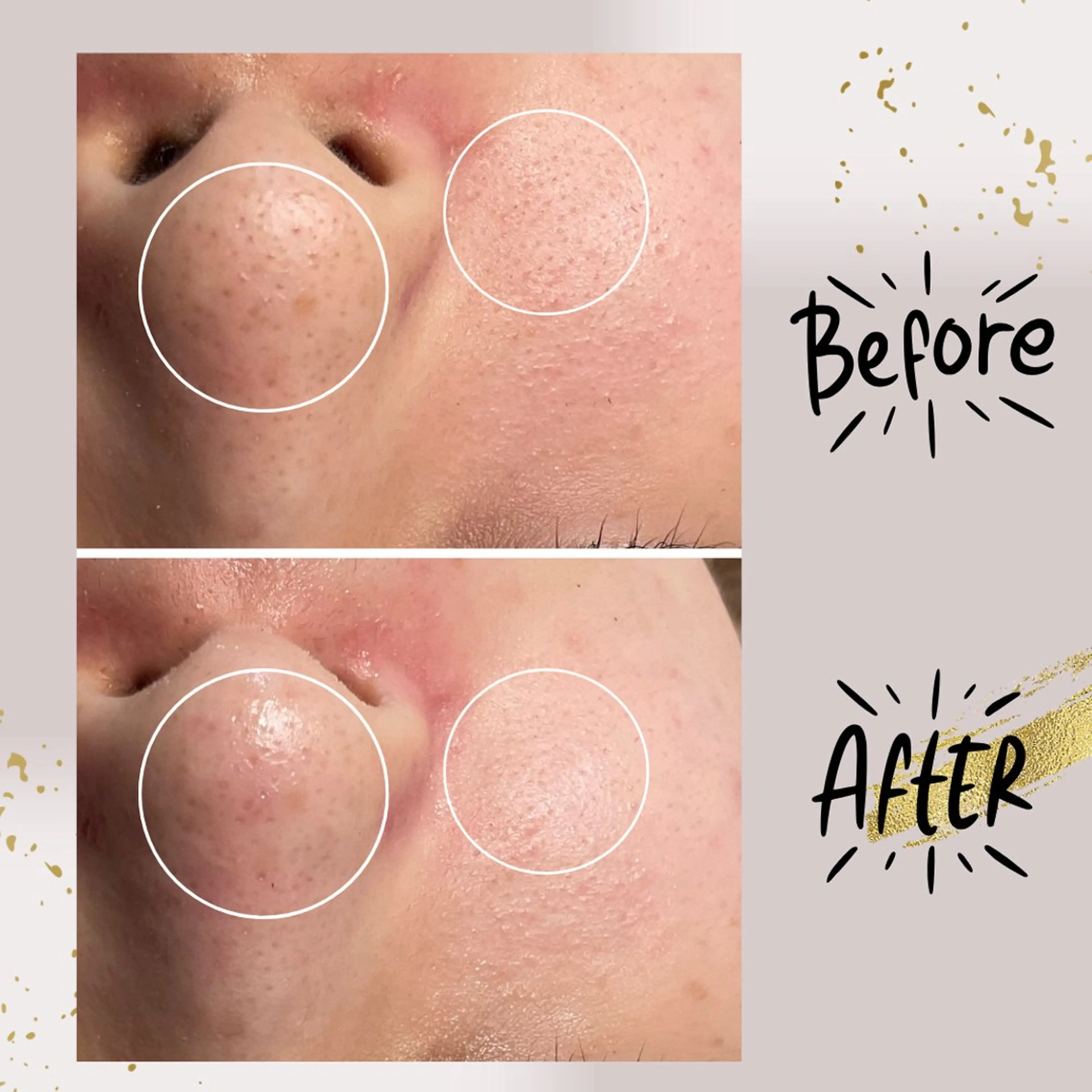 エステ リラク ピーリング専門店 Belluteのエステ・リラクイメージ