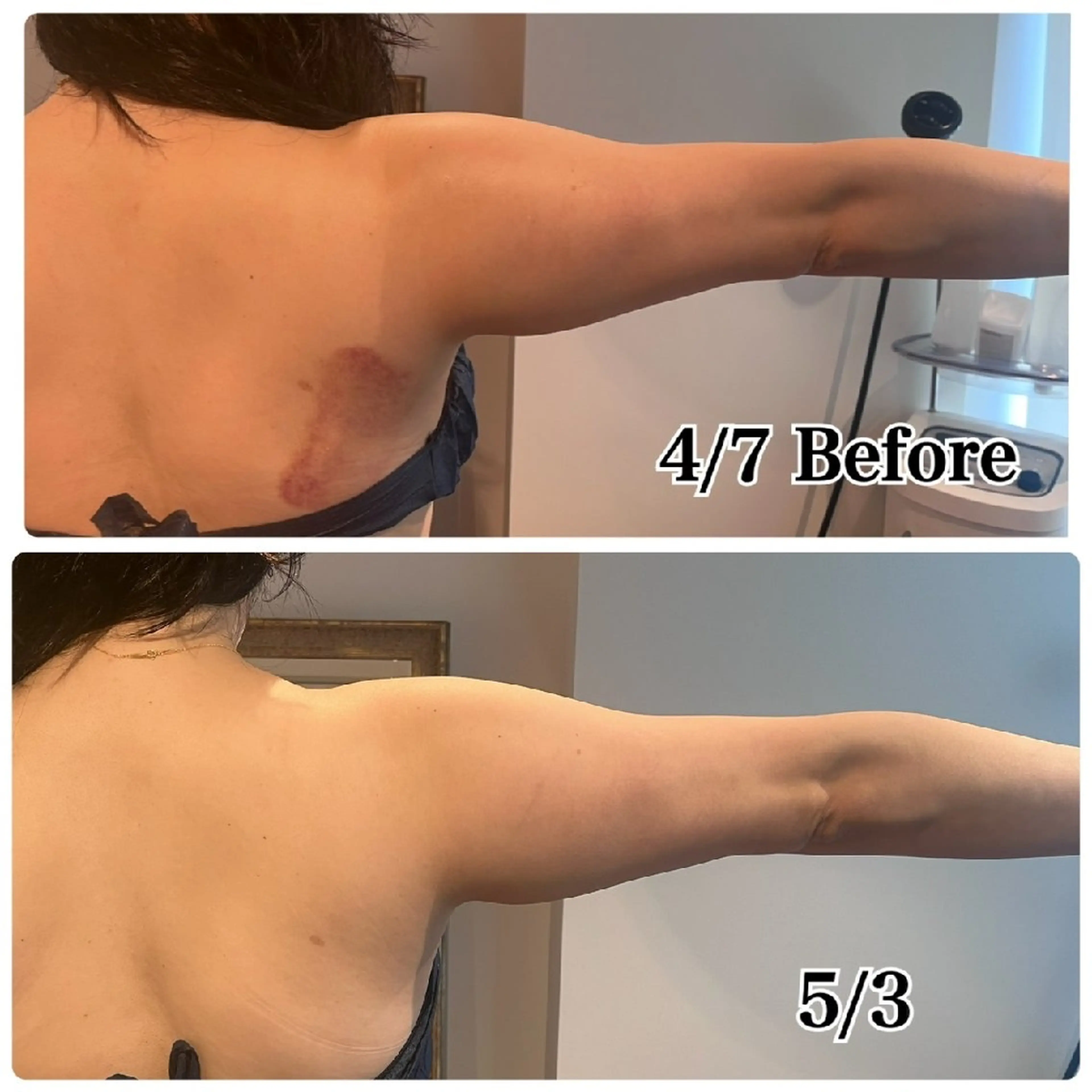 Luanaまつパ脱毛 ハーブピーリング眉毛のマツエク・マツパデザイン