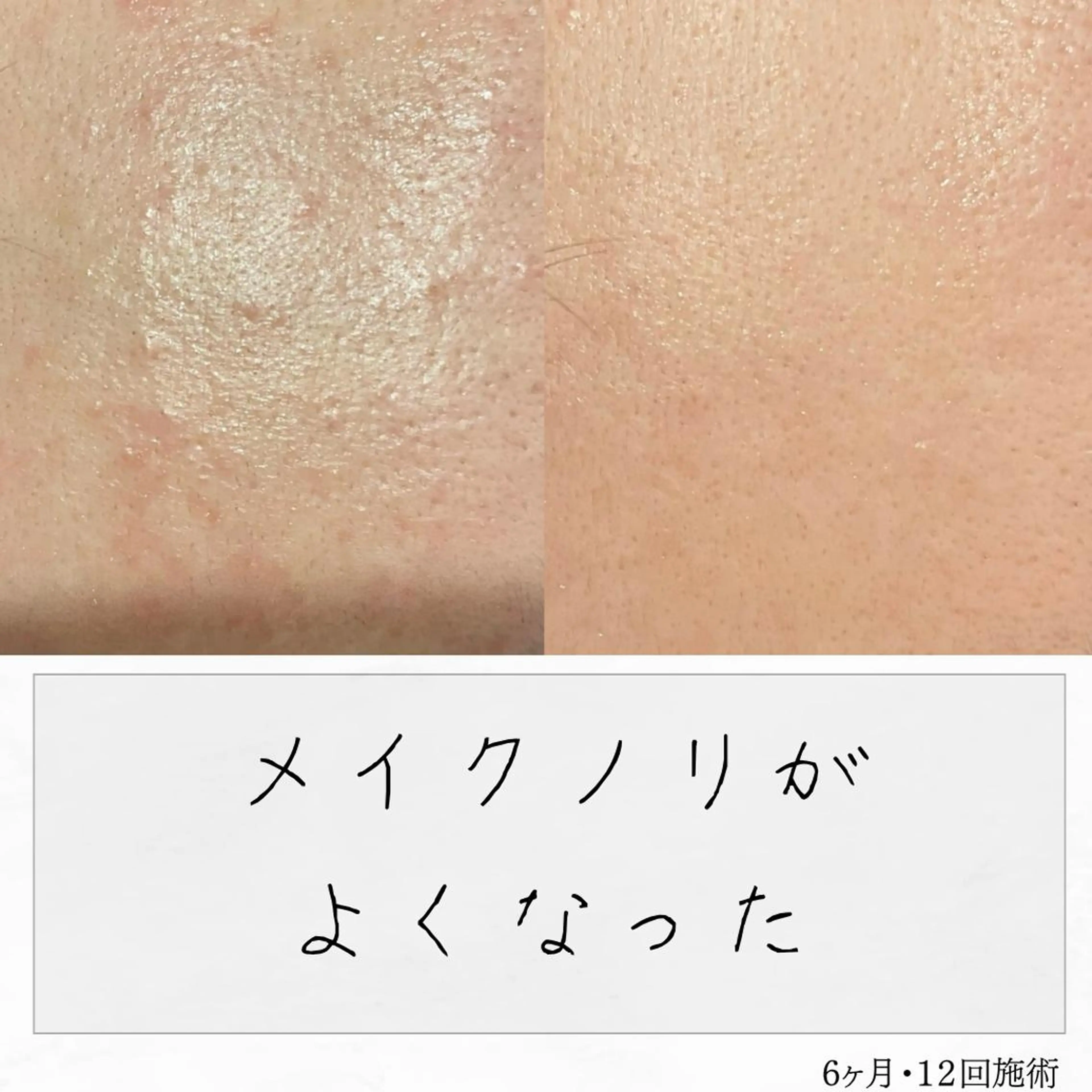 ニキビ経験者が施術 する専門サロン🌻のエステ・リラクイメージ