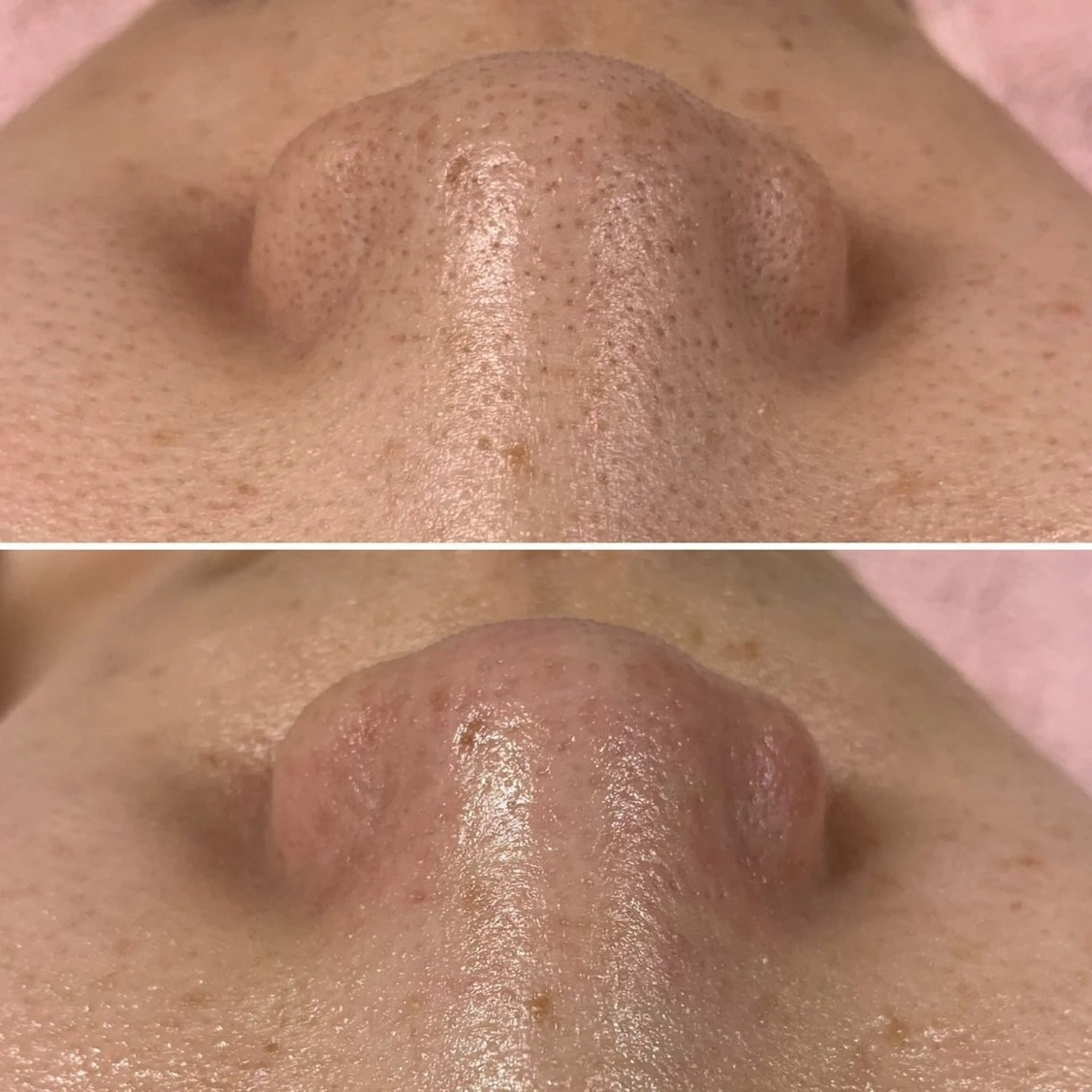 韓国艶美人// 毛穴ケア🌹のエステ・リラクイメージ