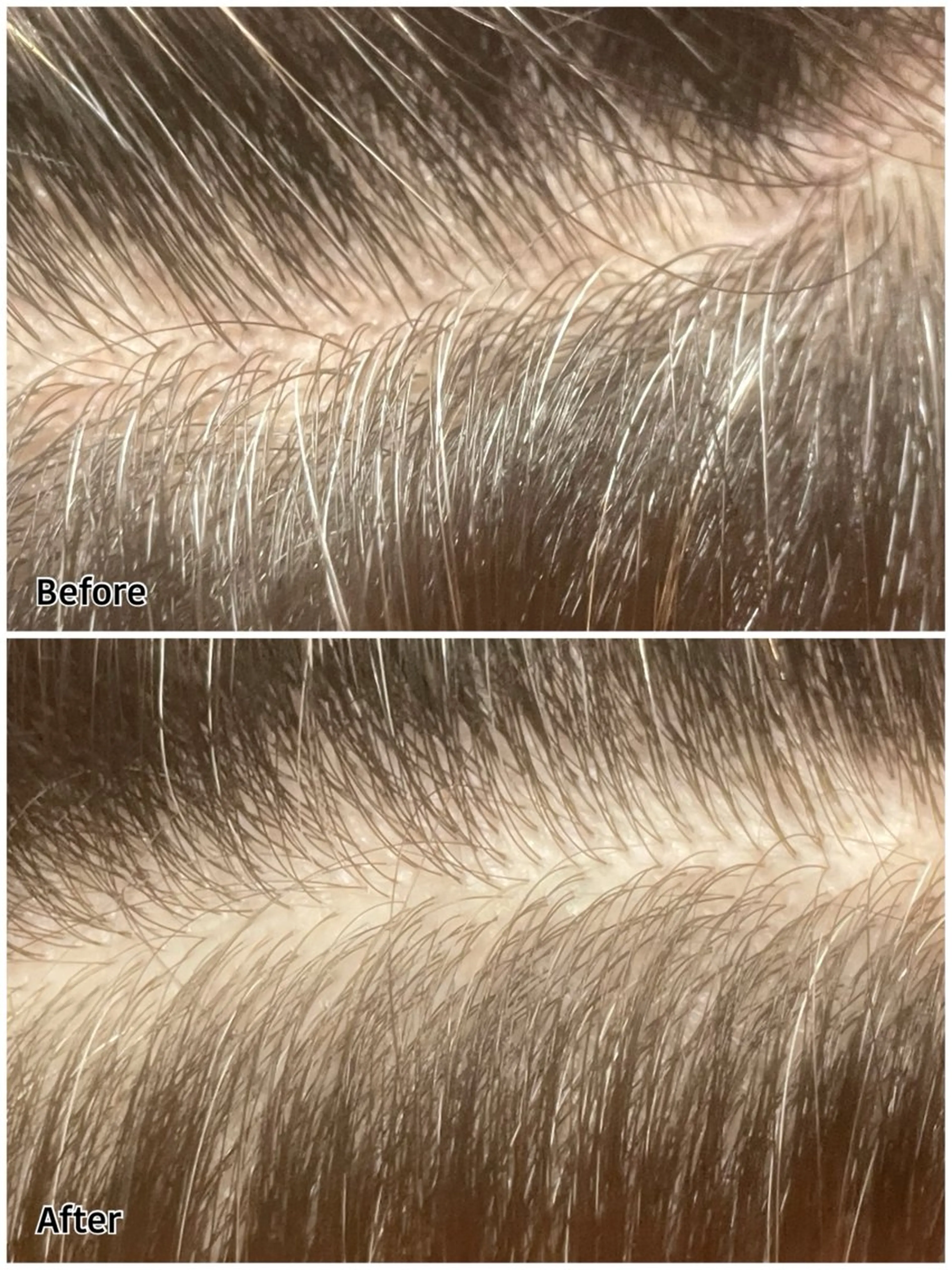 ヘッドキュア＋ドライの写真