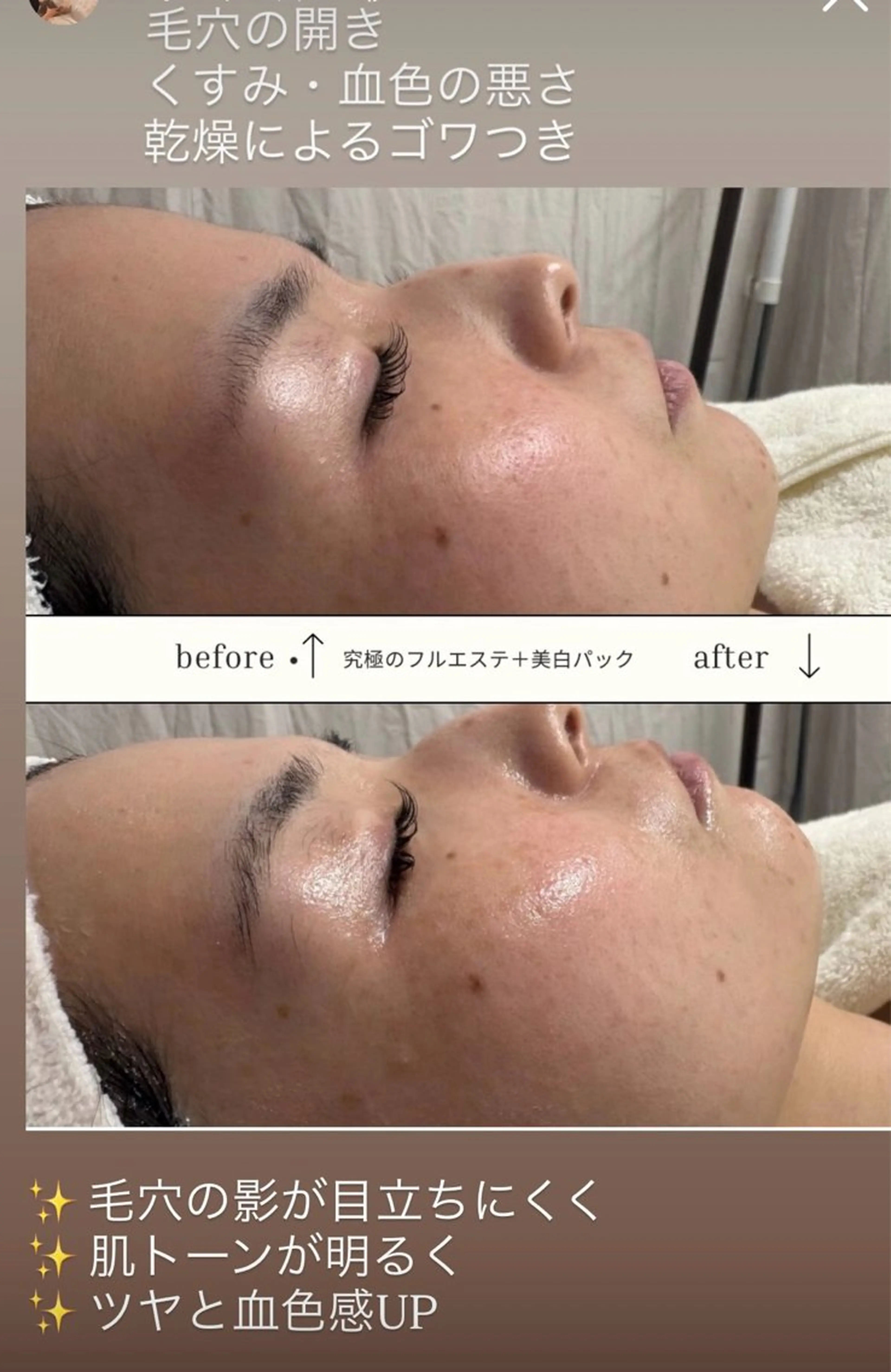 うる艶卵肌フルエステの写真