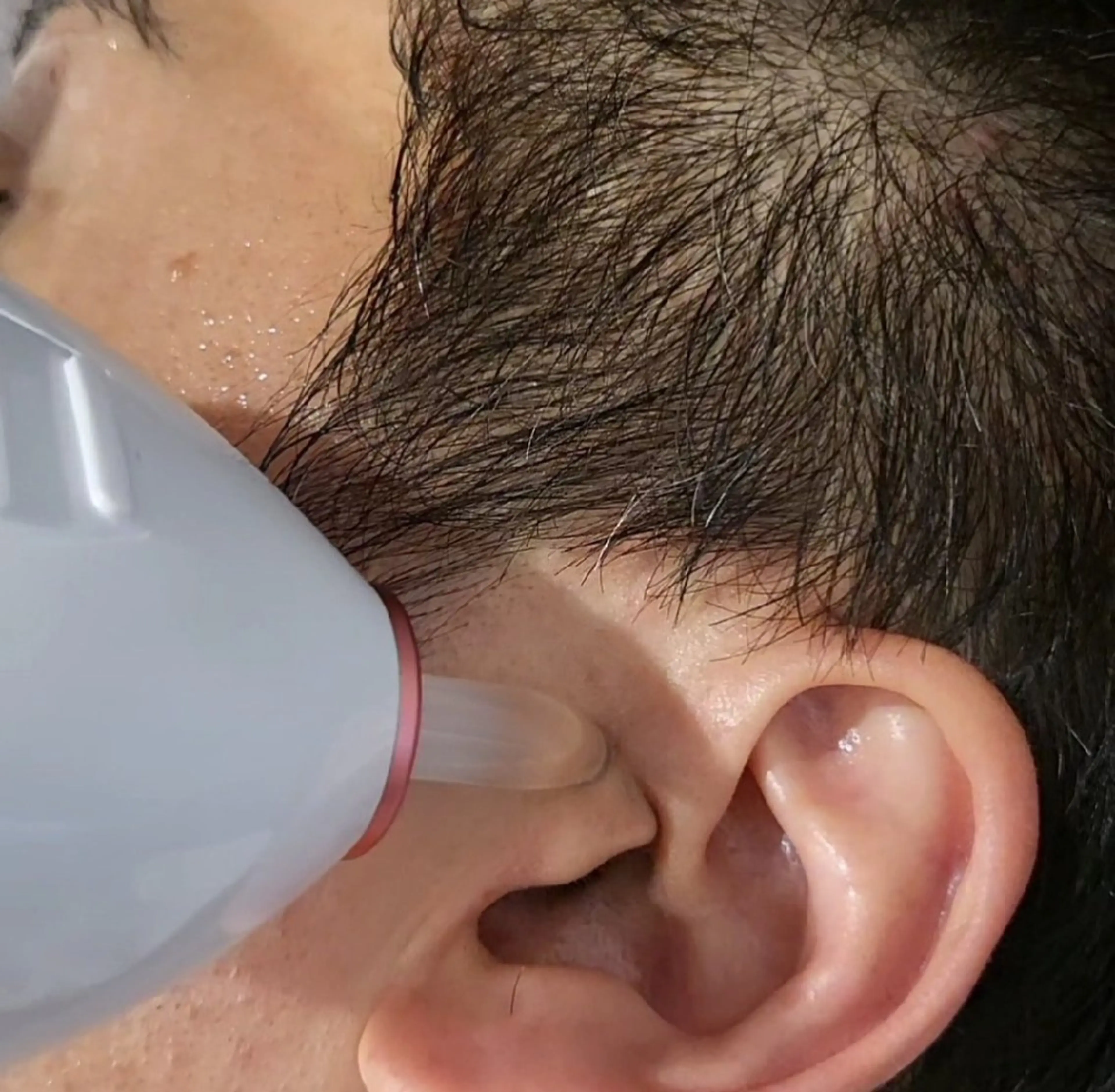 【福岡希少メニュー】自分では見えないからこそ身だしなみは大事！耳毛脱毛　20分　￥3,850→￥1,100回数：1回の写真