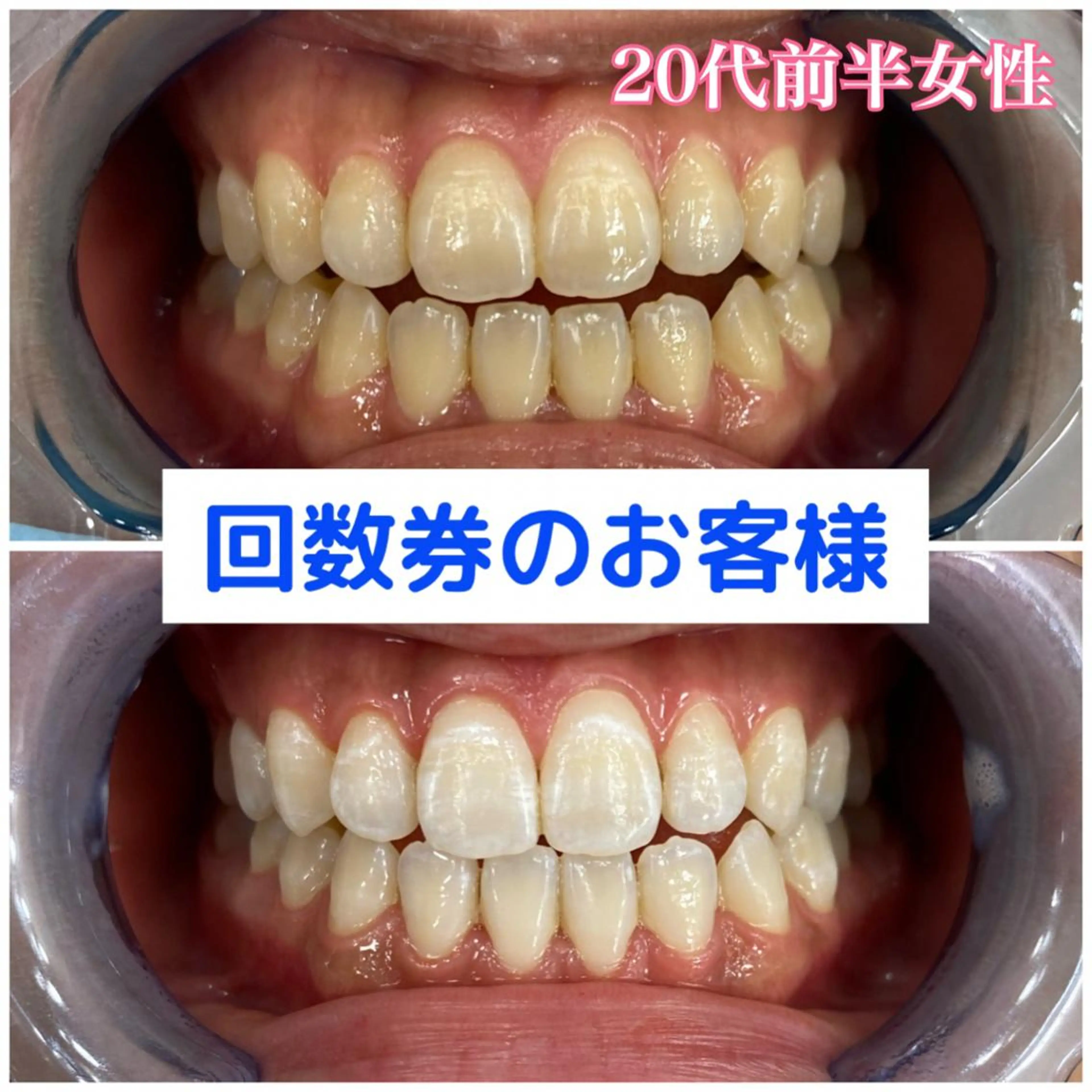 Platinum Beauty 四条烏丸店所属・吉田亮利 ホワイトニング専門店のその他イメージ