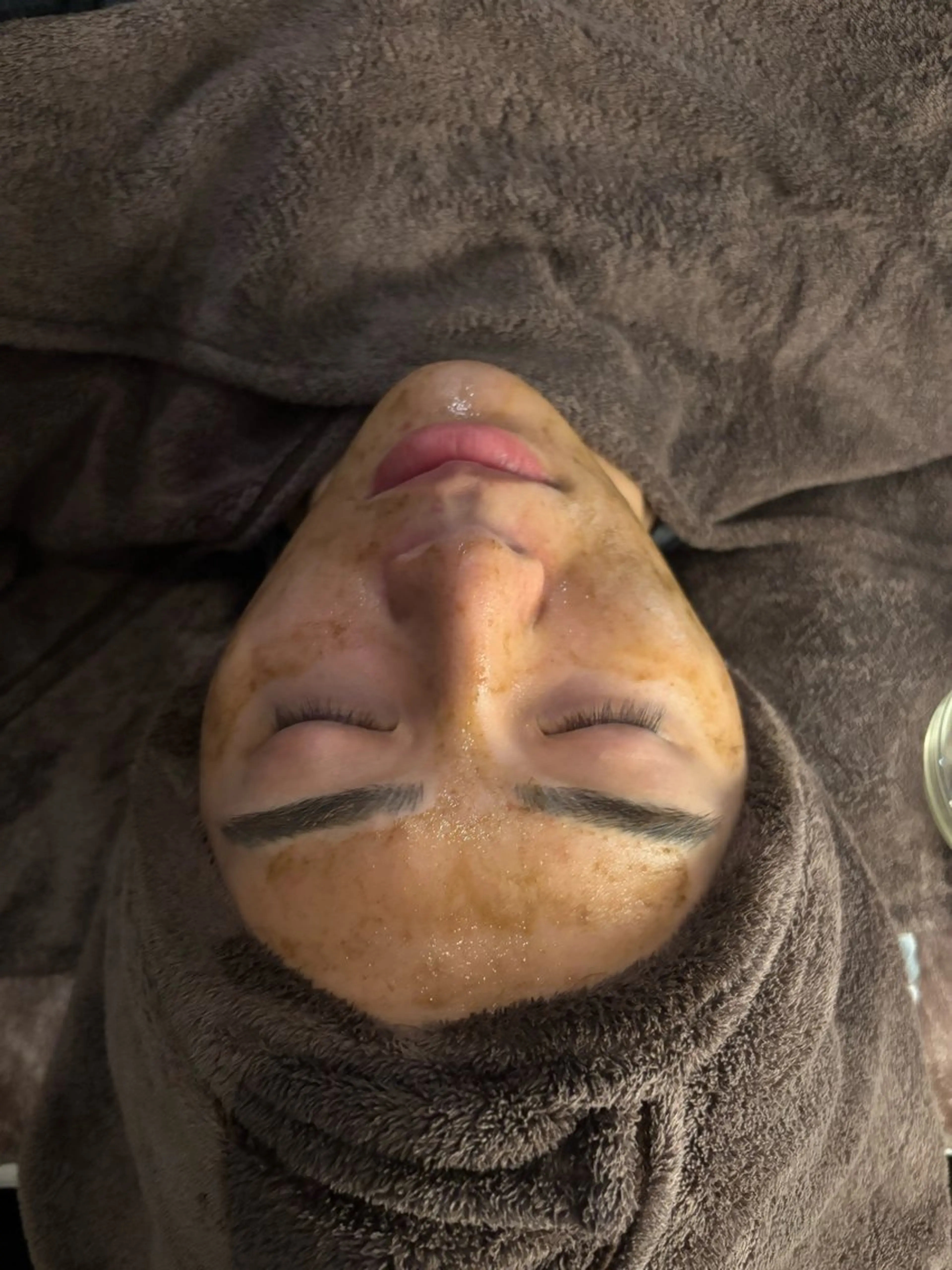 エステ 脱毛／肌質改善 《ulula~梟》のエステ・リラクイメージ