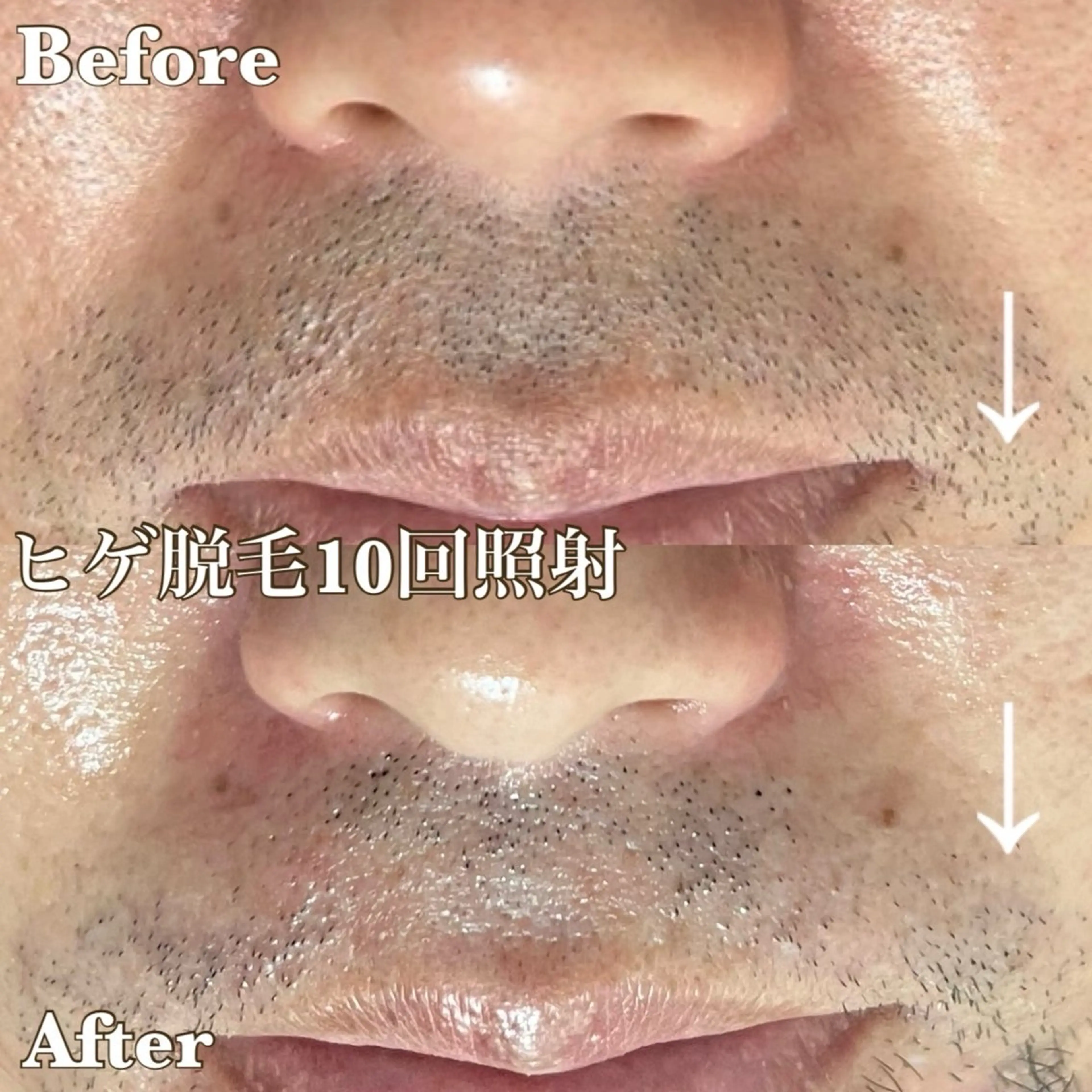 MINOA 井上🌷のエステ・リラクイメージ