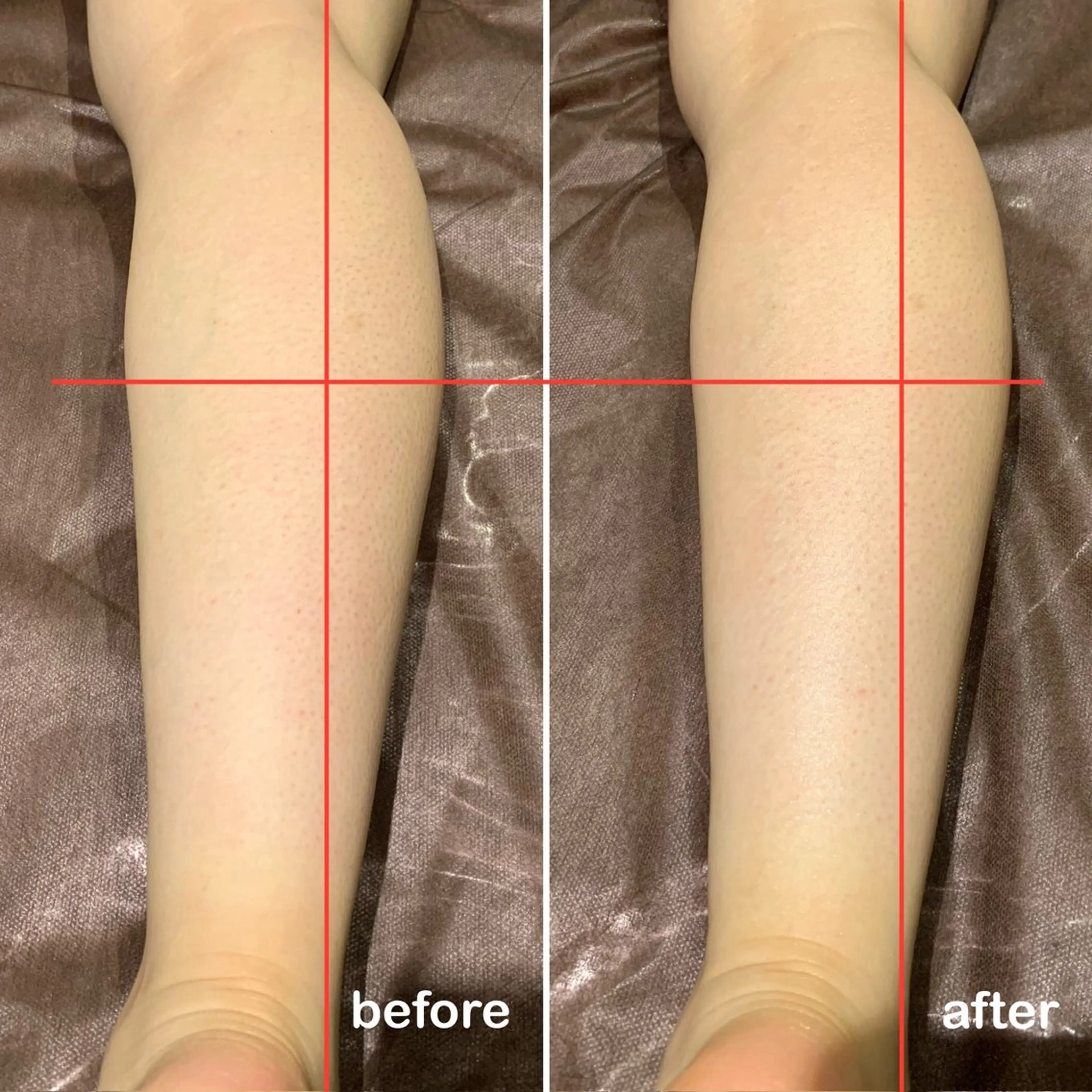 脱毛＆エステサロン JIGGLY☆松田のエステ・リラクイメージ