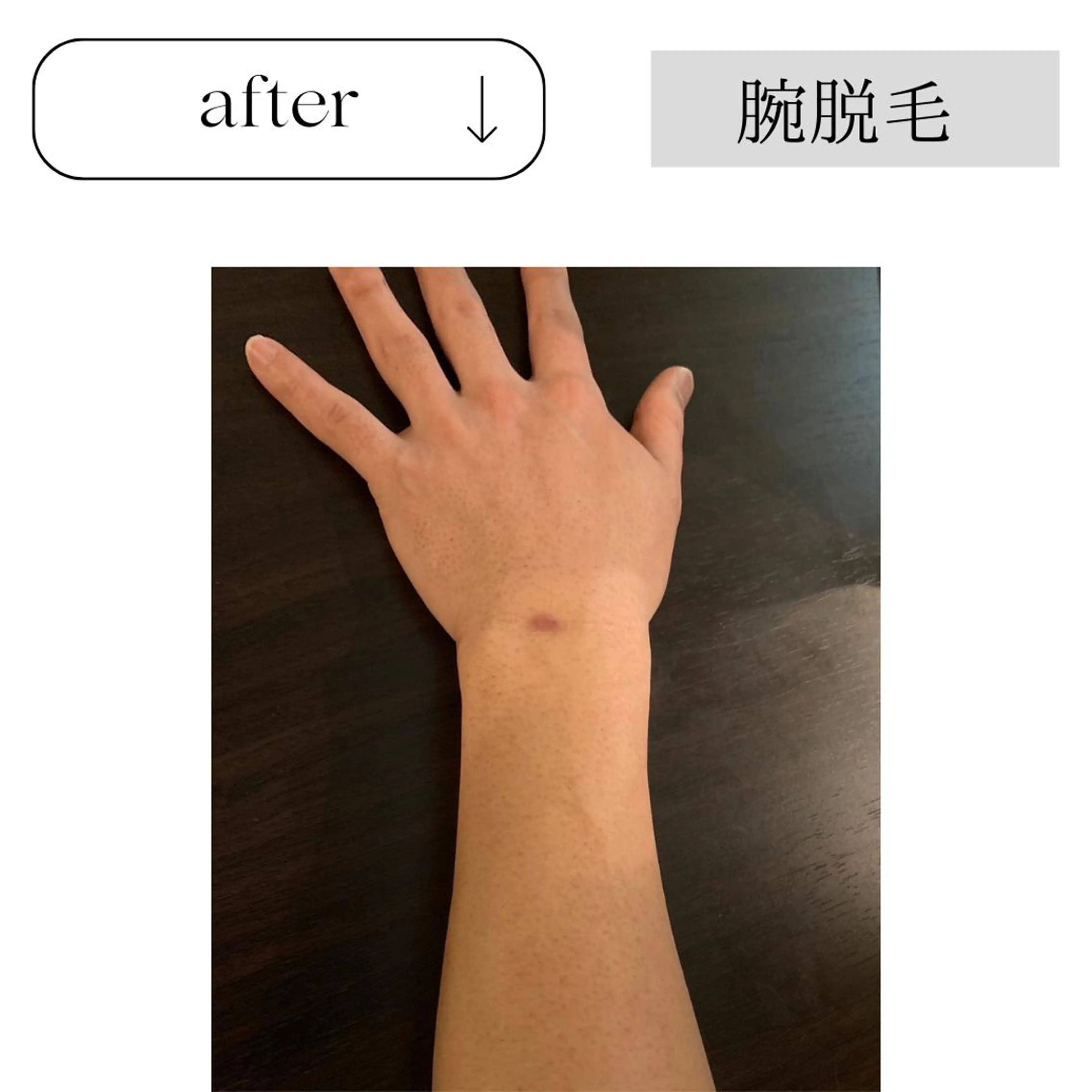 脱毛 beauty CHOOSEのエステ・リラクイメージ
