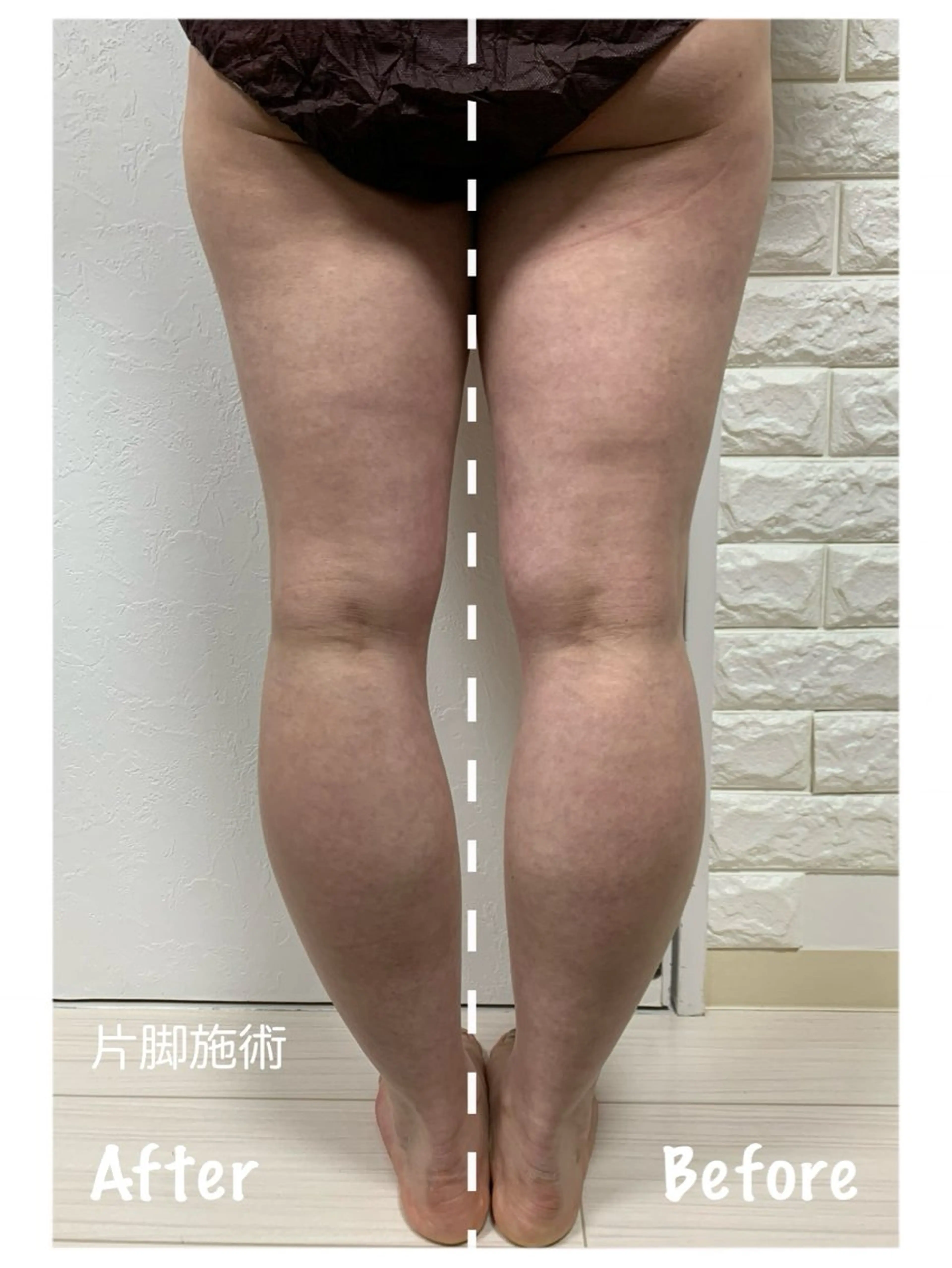 エステ リラク KalanDiva〜 ｶﾗﾝﾃﾞｨｰﾊﾞ〜のエステ・リラクイメージ