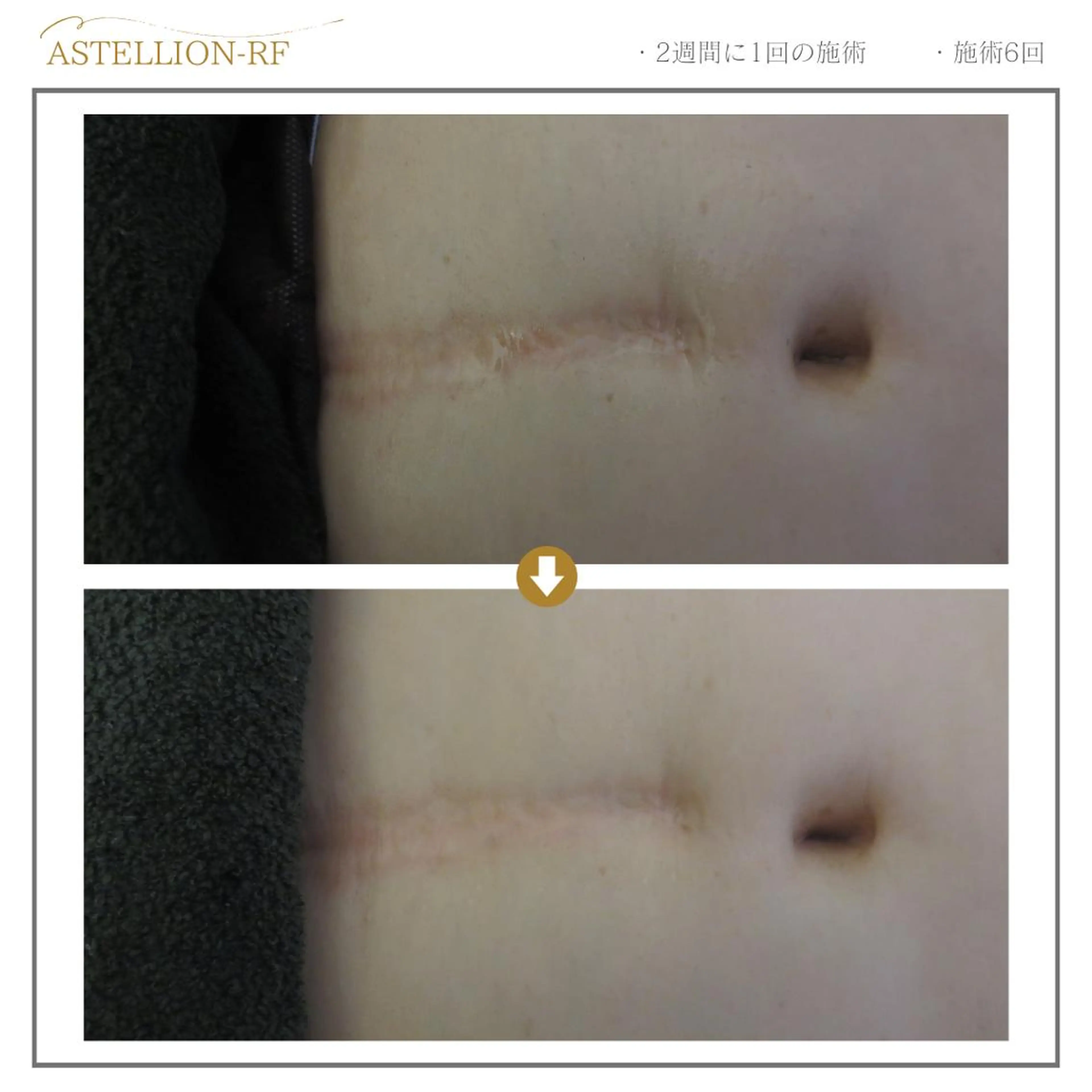 シルフィア｜ 小顔／深層マッサージのエステ・リラクイメージ