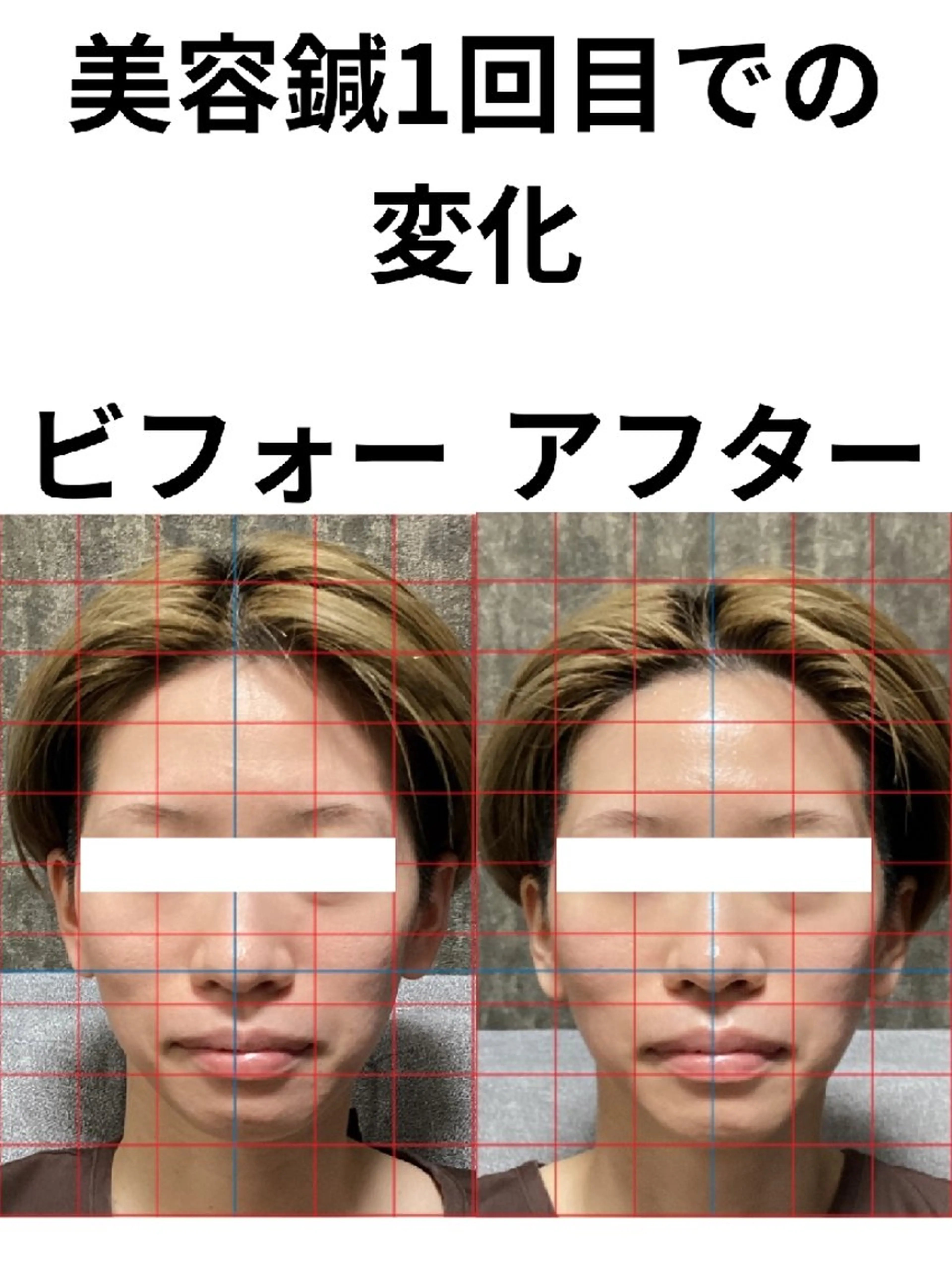 その他 鍼灸整体院 アレンジのその他イメージ