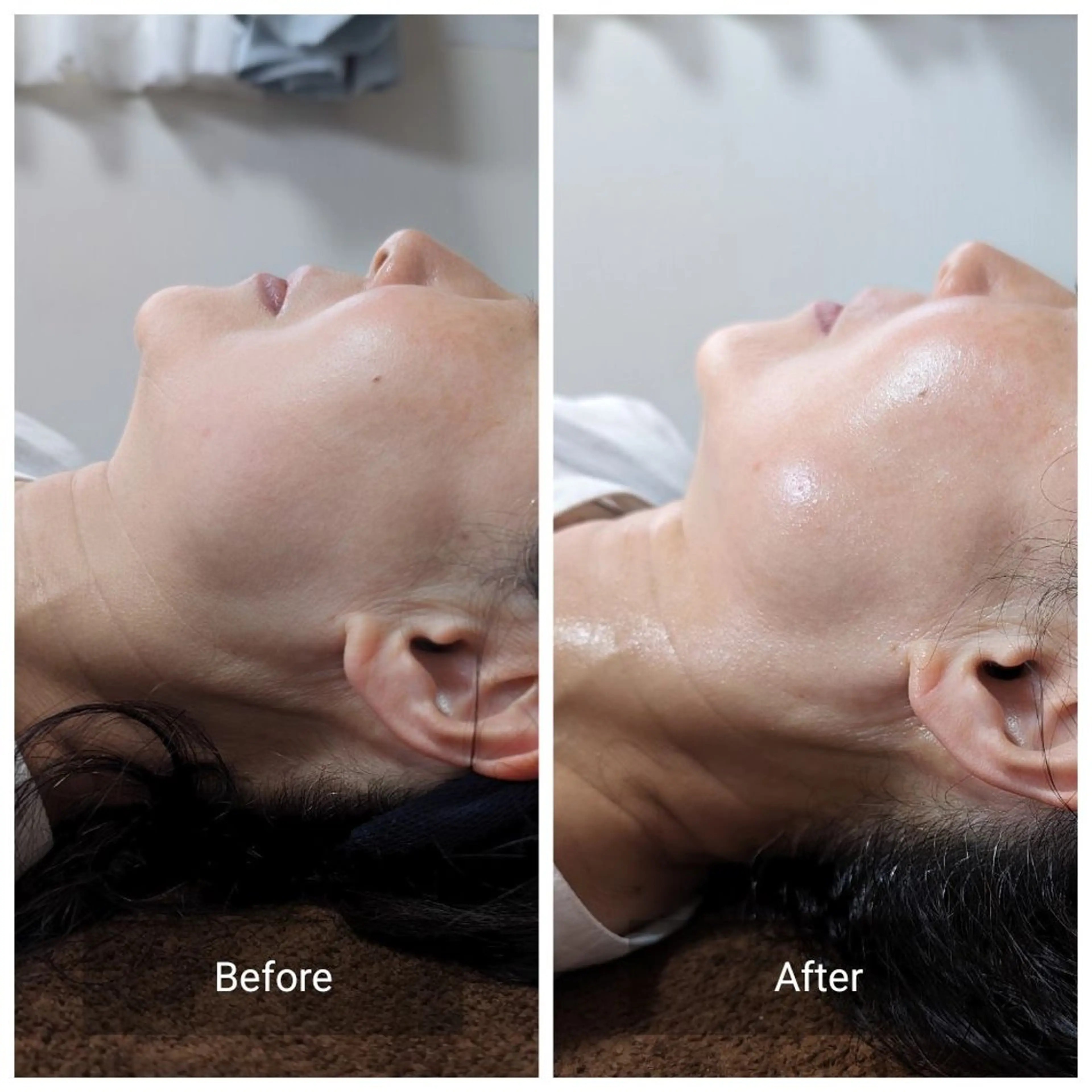 エステ nail RiRi アトレナチュラのエステ・リラクイメージ