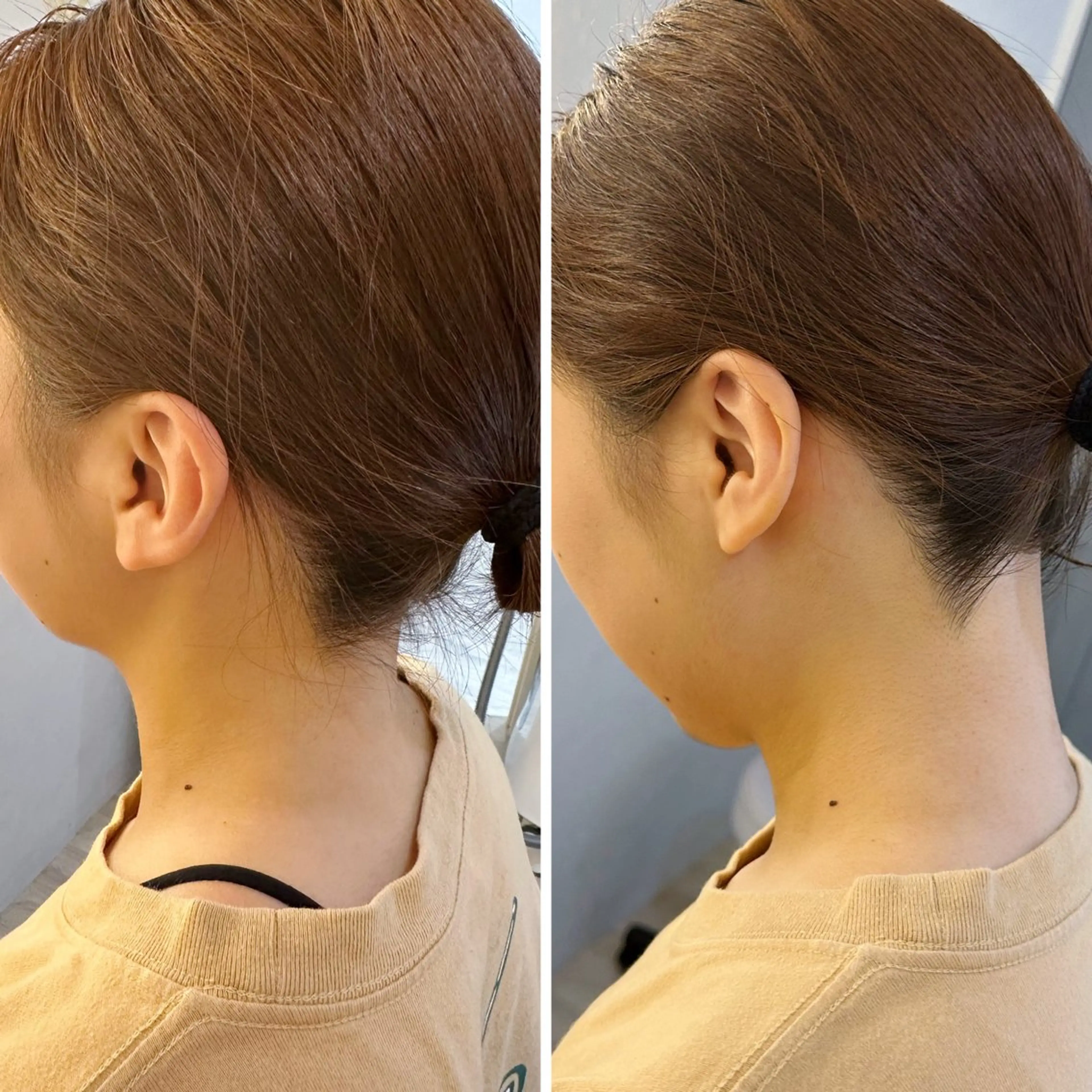 脱毛 うなじ脱毛/美肌脱毛 LABELのエステ・リラクイメージ