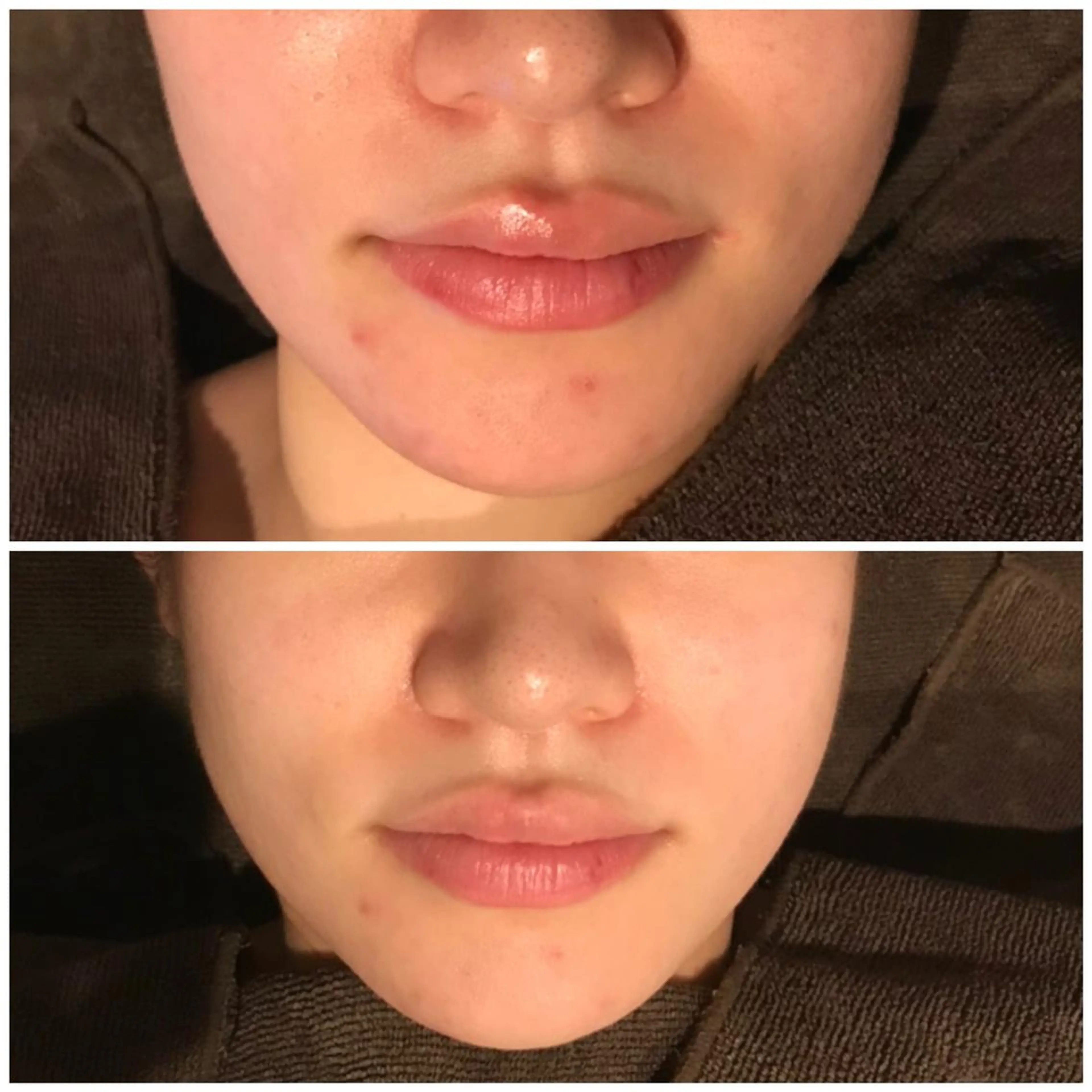 プルケル スパのエステ・リラクイメージ