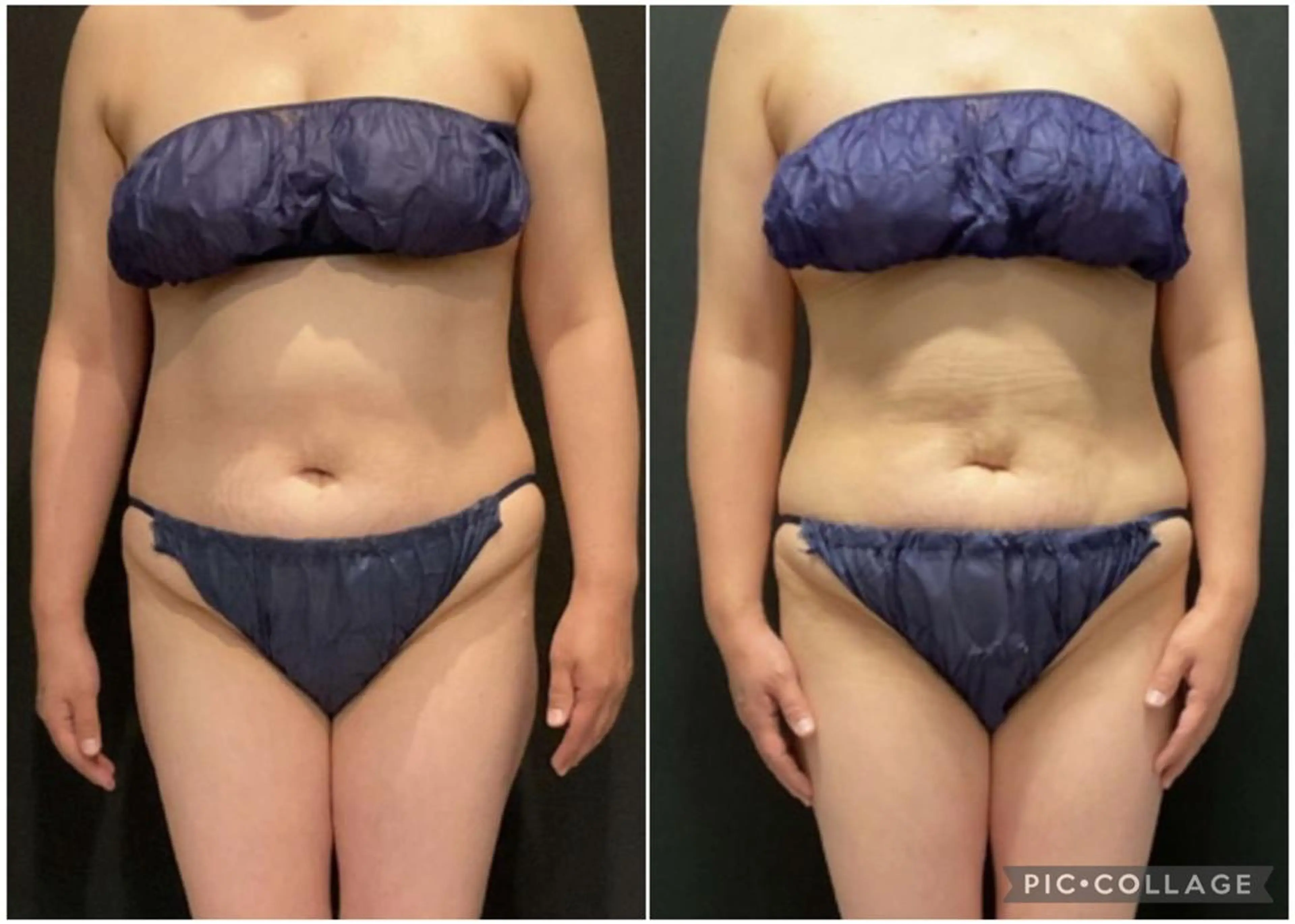 エステ リラク エヴァーグレース 金山店のエステ・リラクイメージ