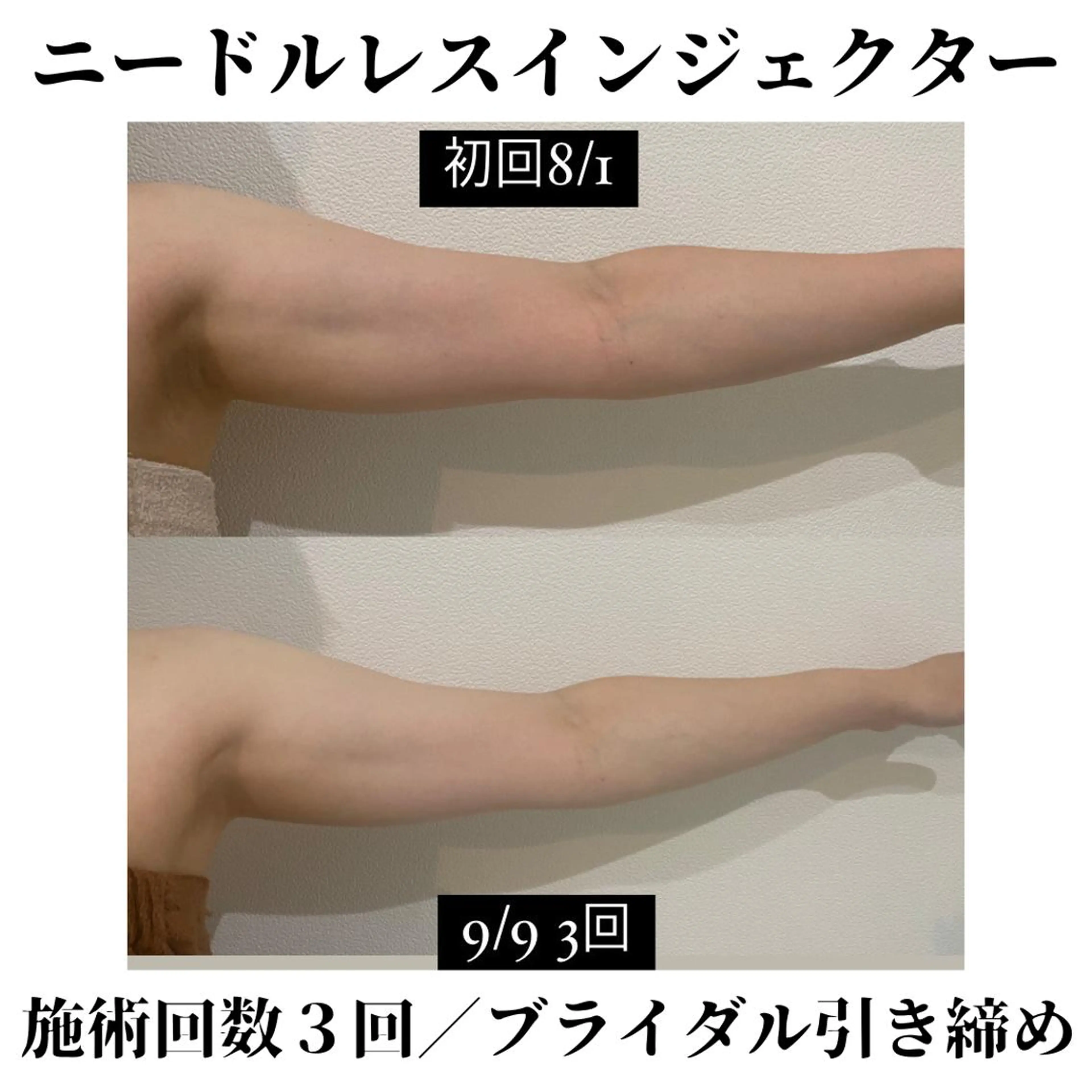 トータルビューティー サロンSalaのマツエク・マツパデザイン