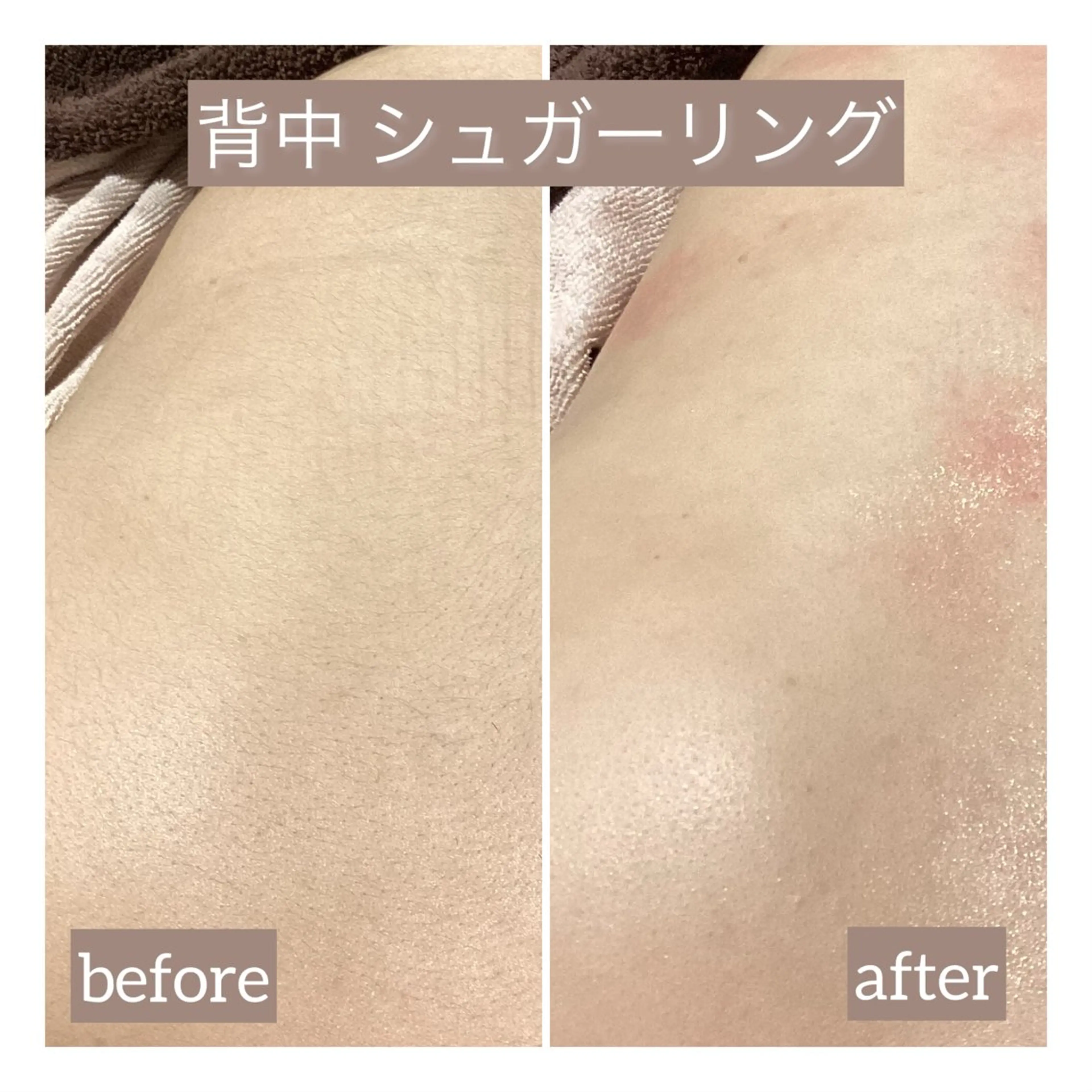 脱毛 脱毛＆エステサロン JIGGLY☆松田のエステ・リラクイメージ