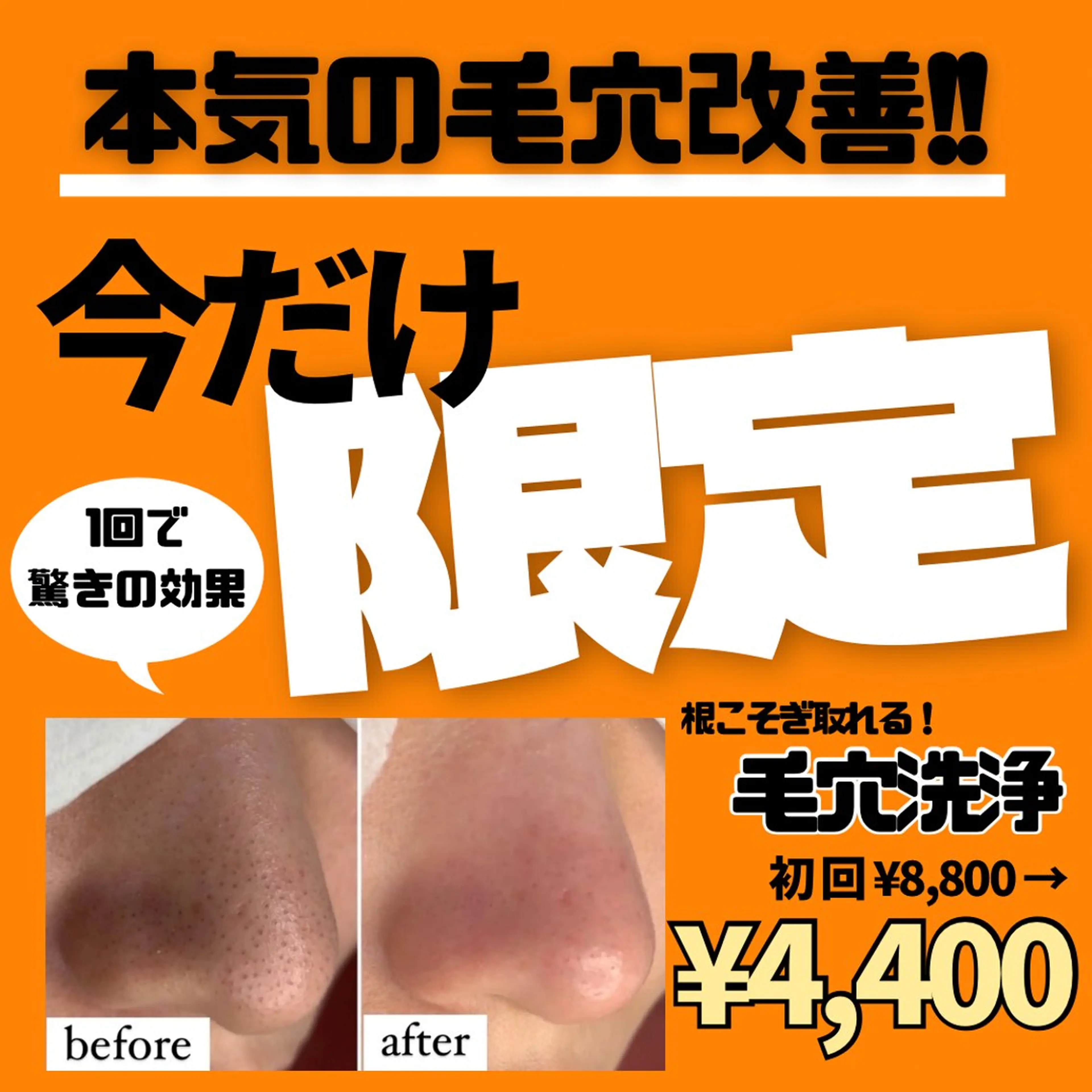 今だけ限定‼️表面だけでは終わらせない毛穴洗浄✨の写真