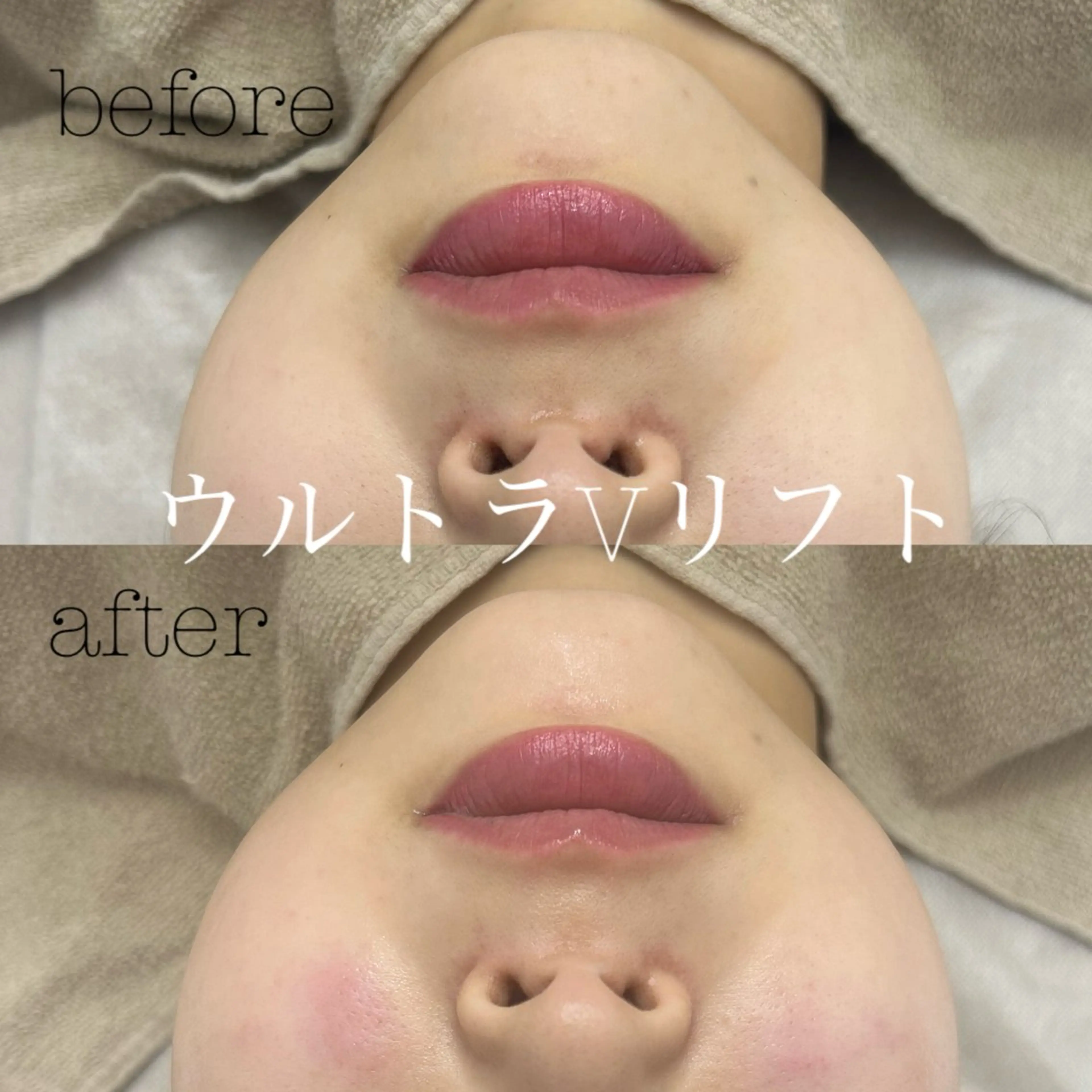 エステ フェイシャルサロン CHIARA 荒田のエステ・リラクイメージ