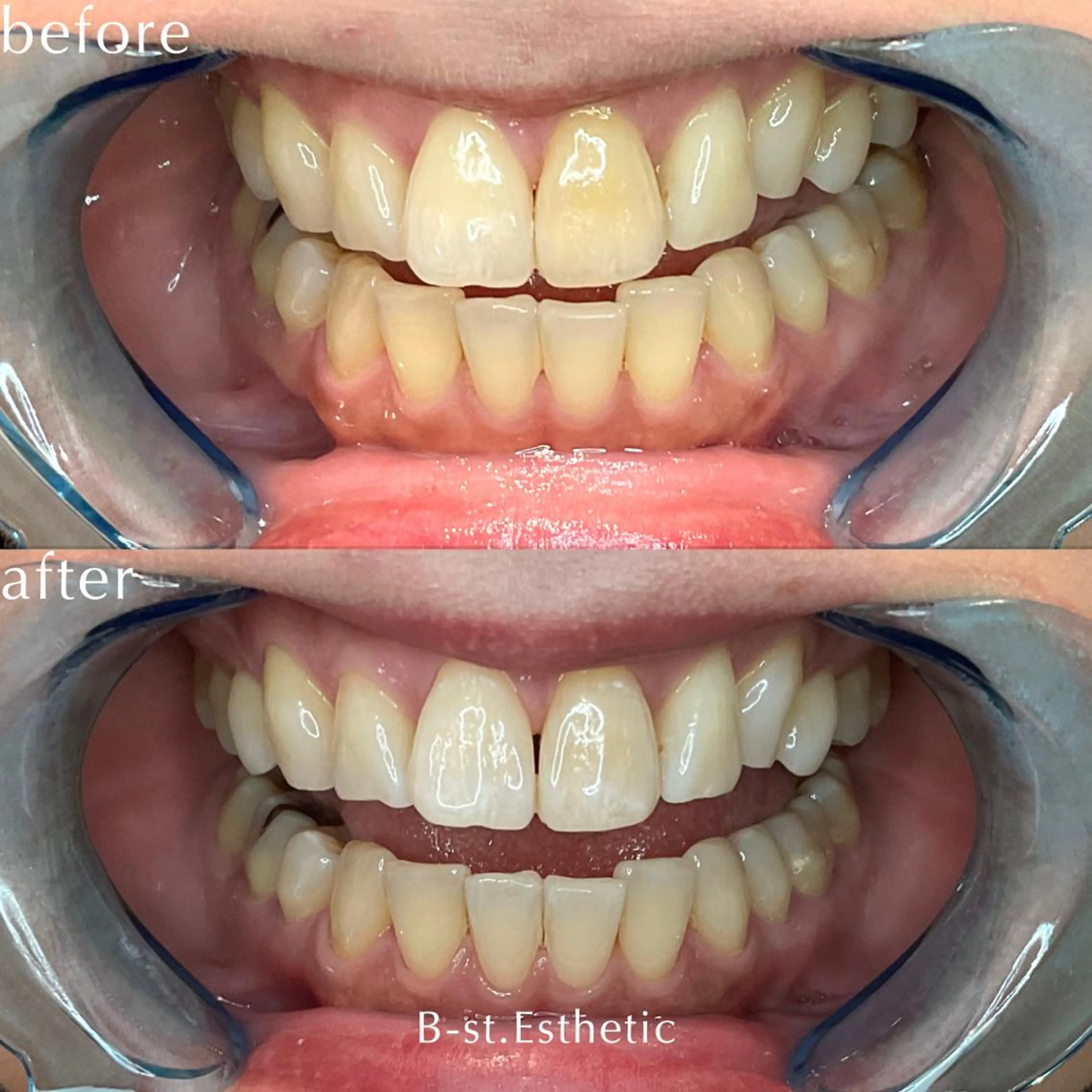 B-st. 下北沢のその他イメージ
