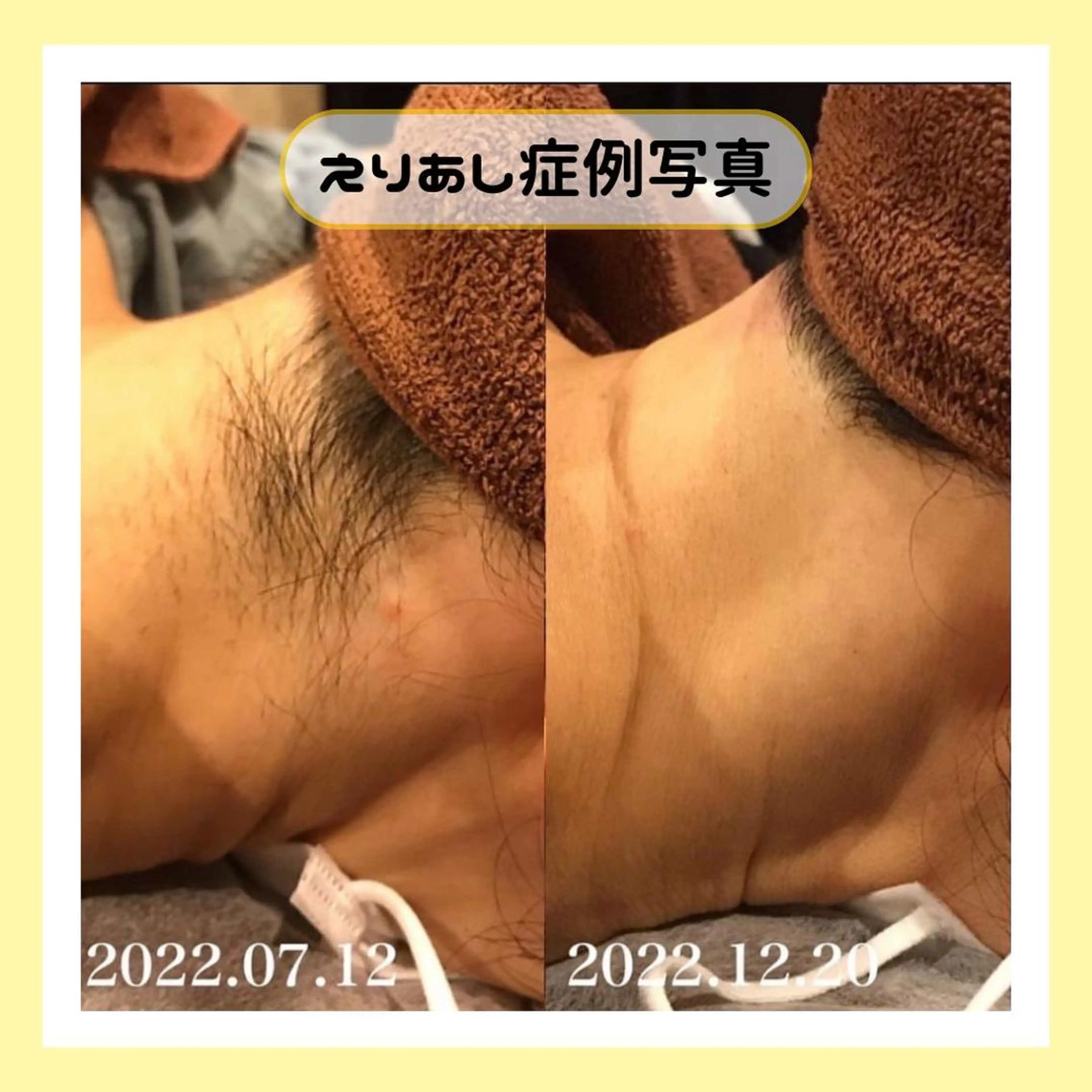 金山/脱毛/美肌 ULULUのエステ・リラクイメージ