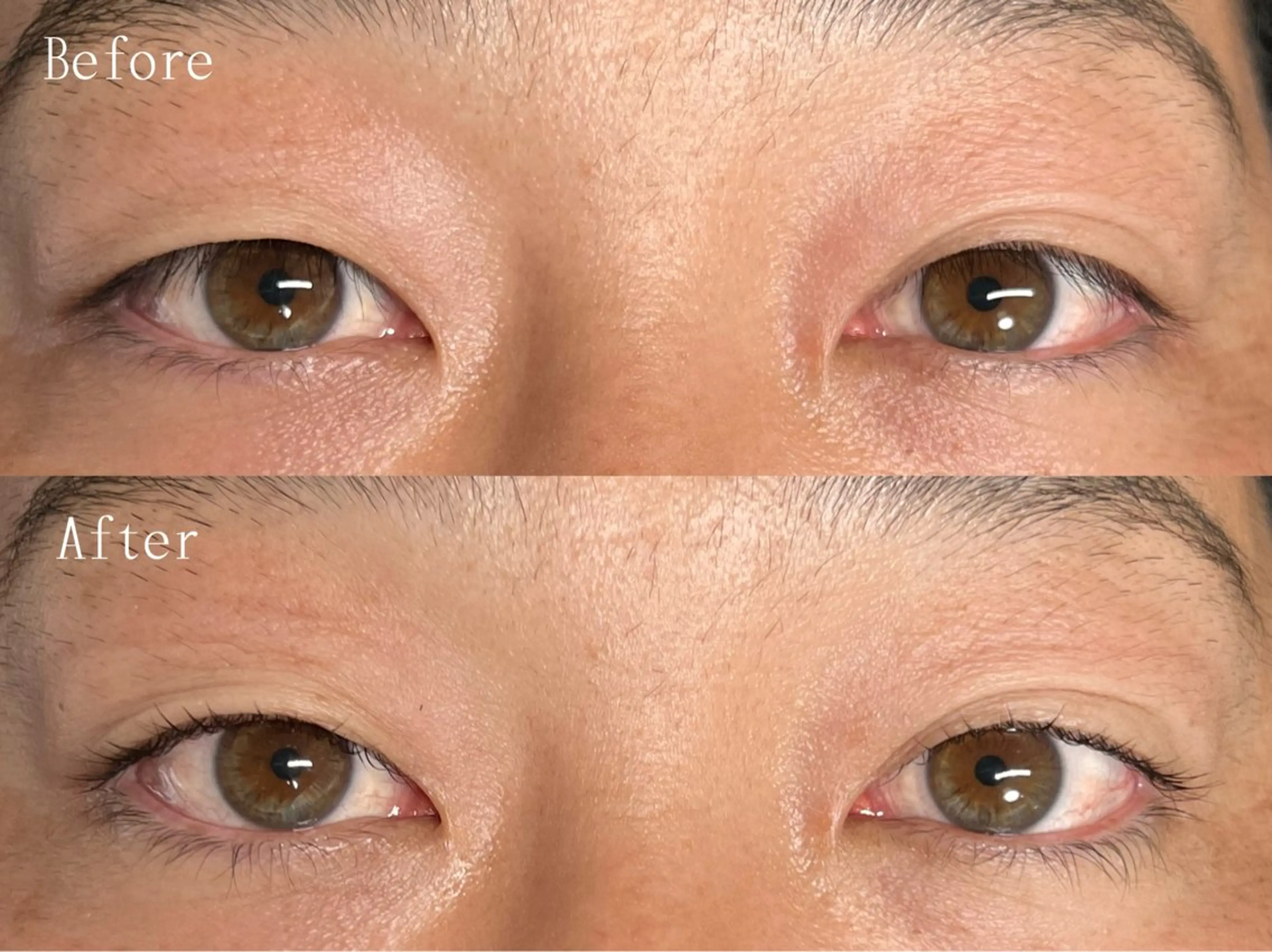 ＼逆まつげ解消‼️／メンズまつ毛パーマ【 視界良好👀✨ 】の写真