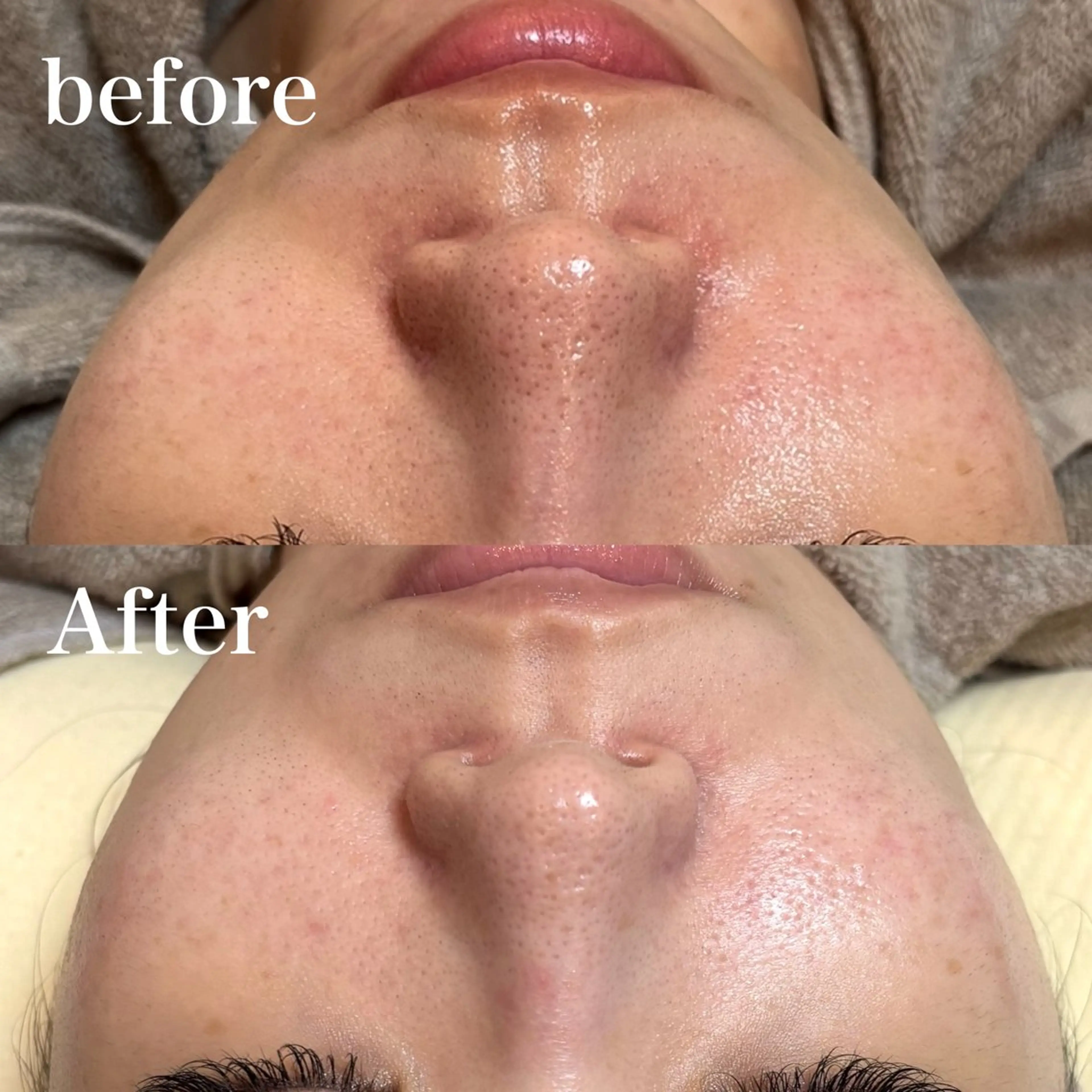 unsui spa 渋谷区神泉のエステ・リラクイメージ