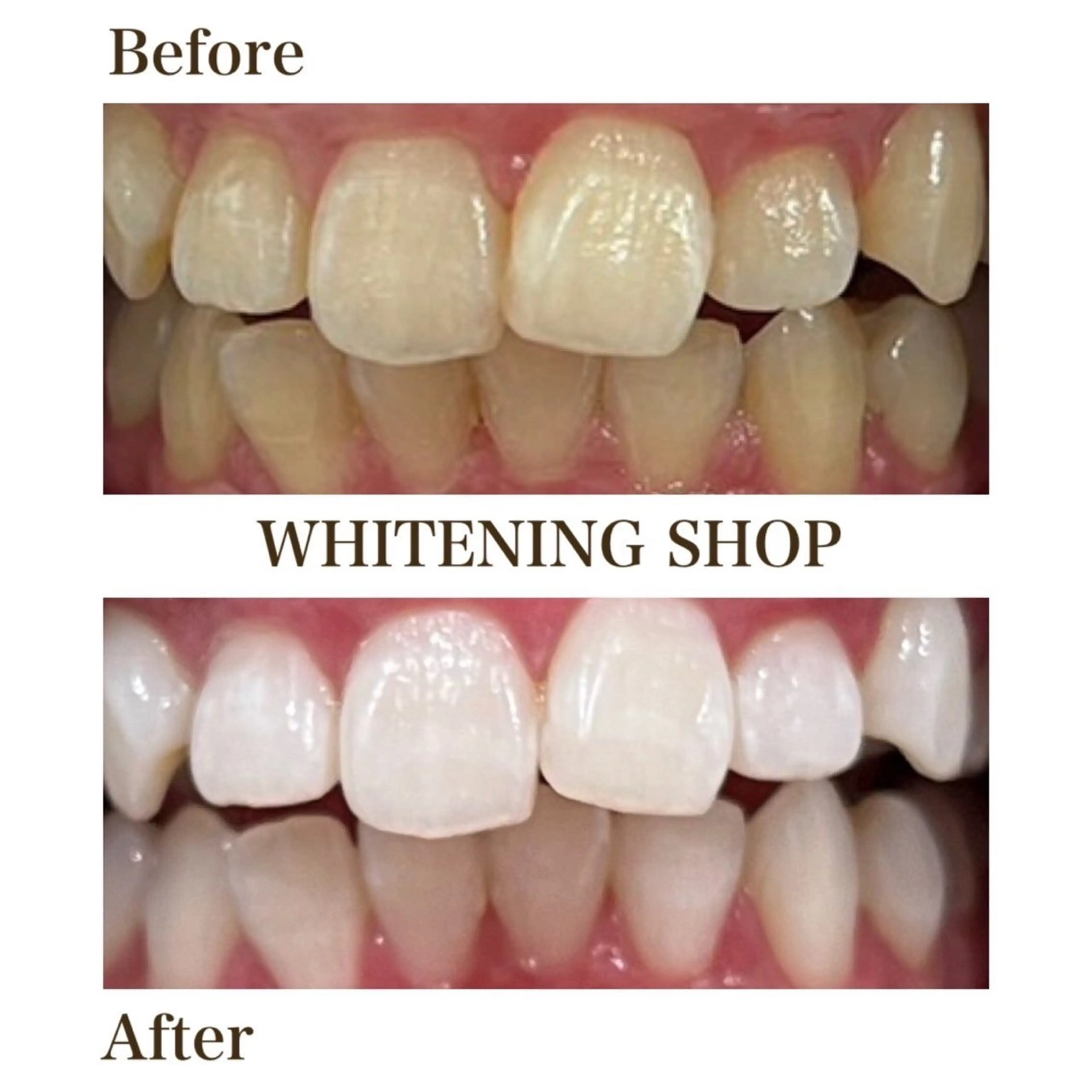 ホワイトニング ショップ川越店のエステ・リラクイメージ