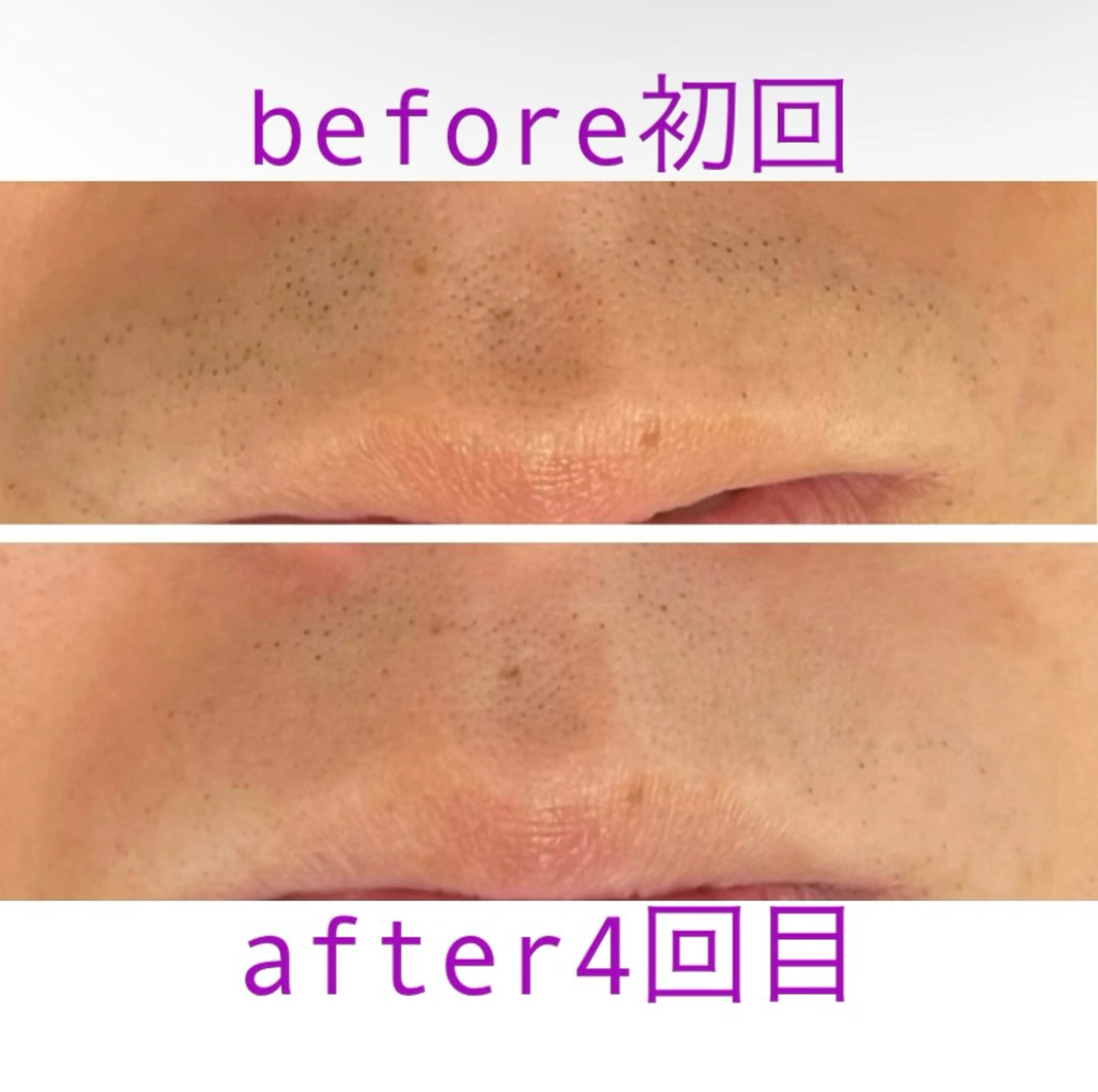 esthesalon O'-en-のエステ・リラクイメージ