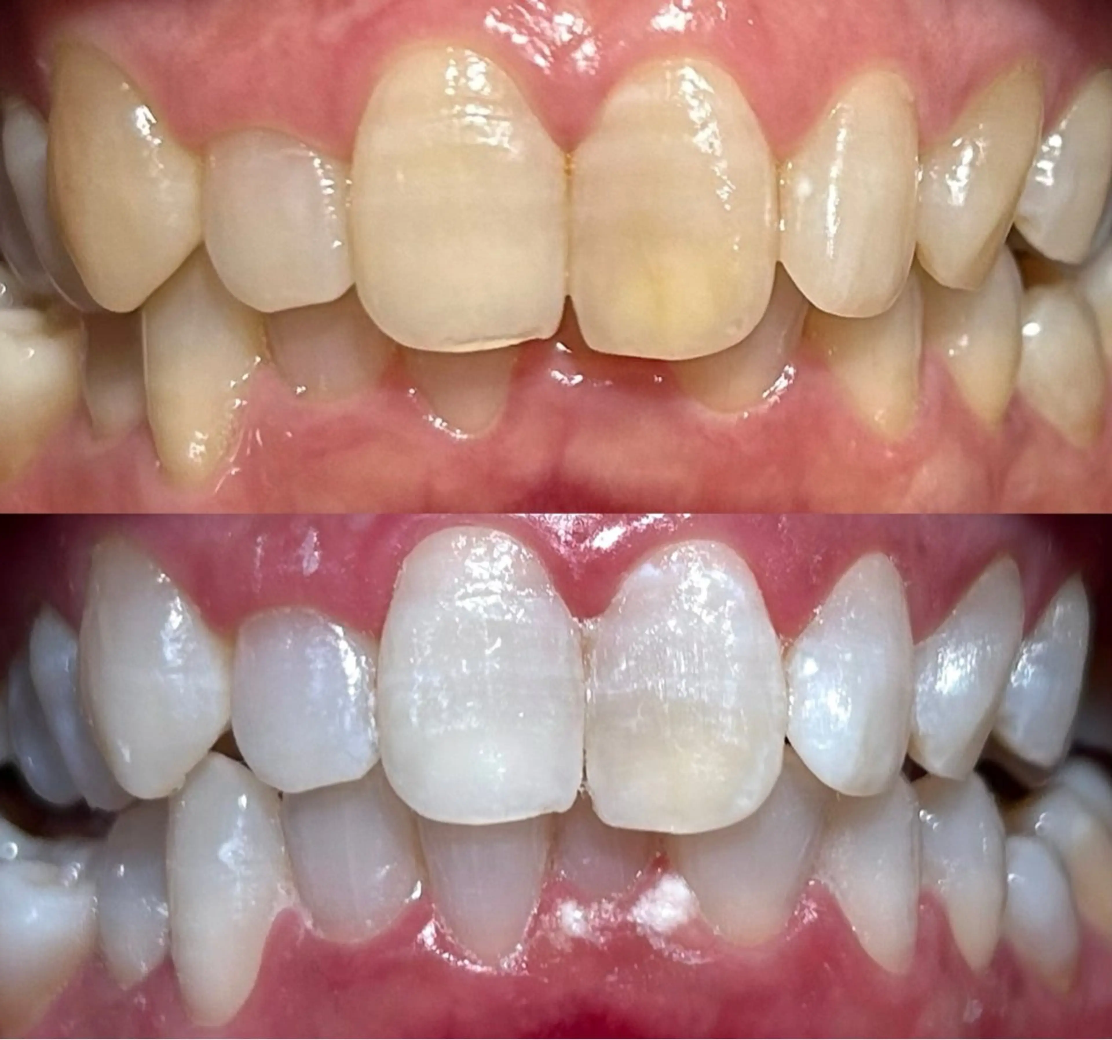 io teeth careのその他イメージ