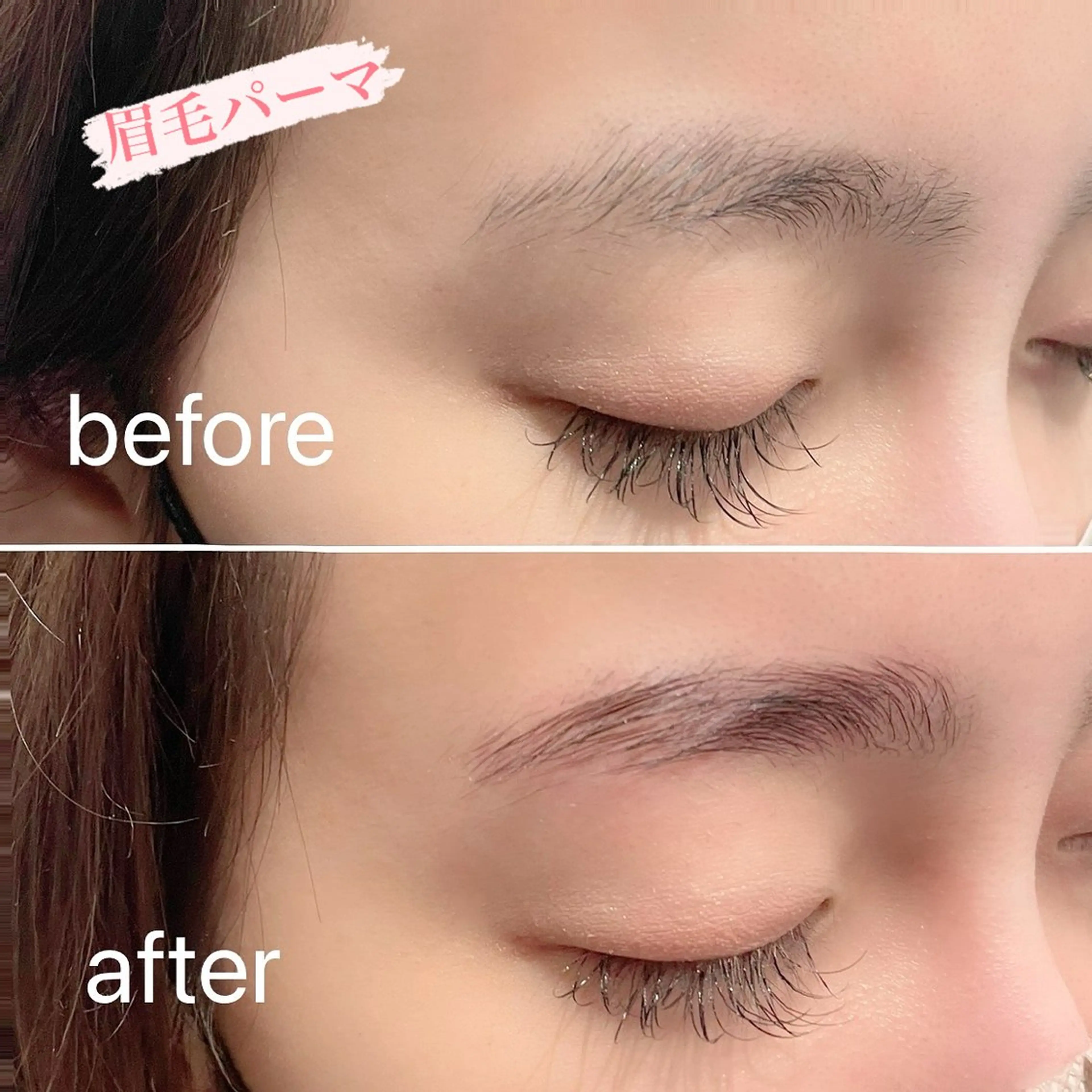 痛くないシミ取り 【荻窪】石橋のヘアスタイル
