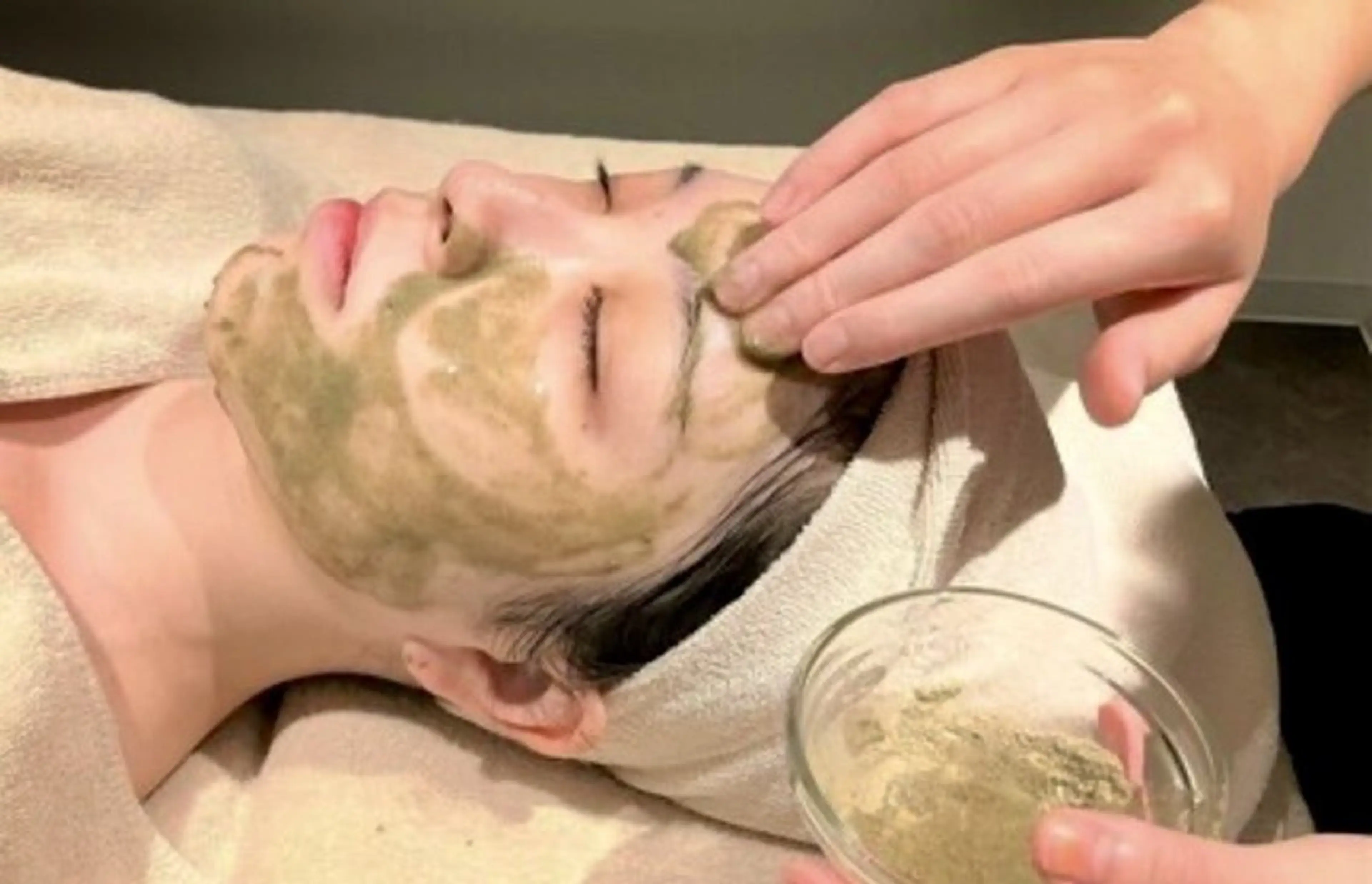 ハーブピーリング剥離あり　水光肌　GF美容液付の写真