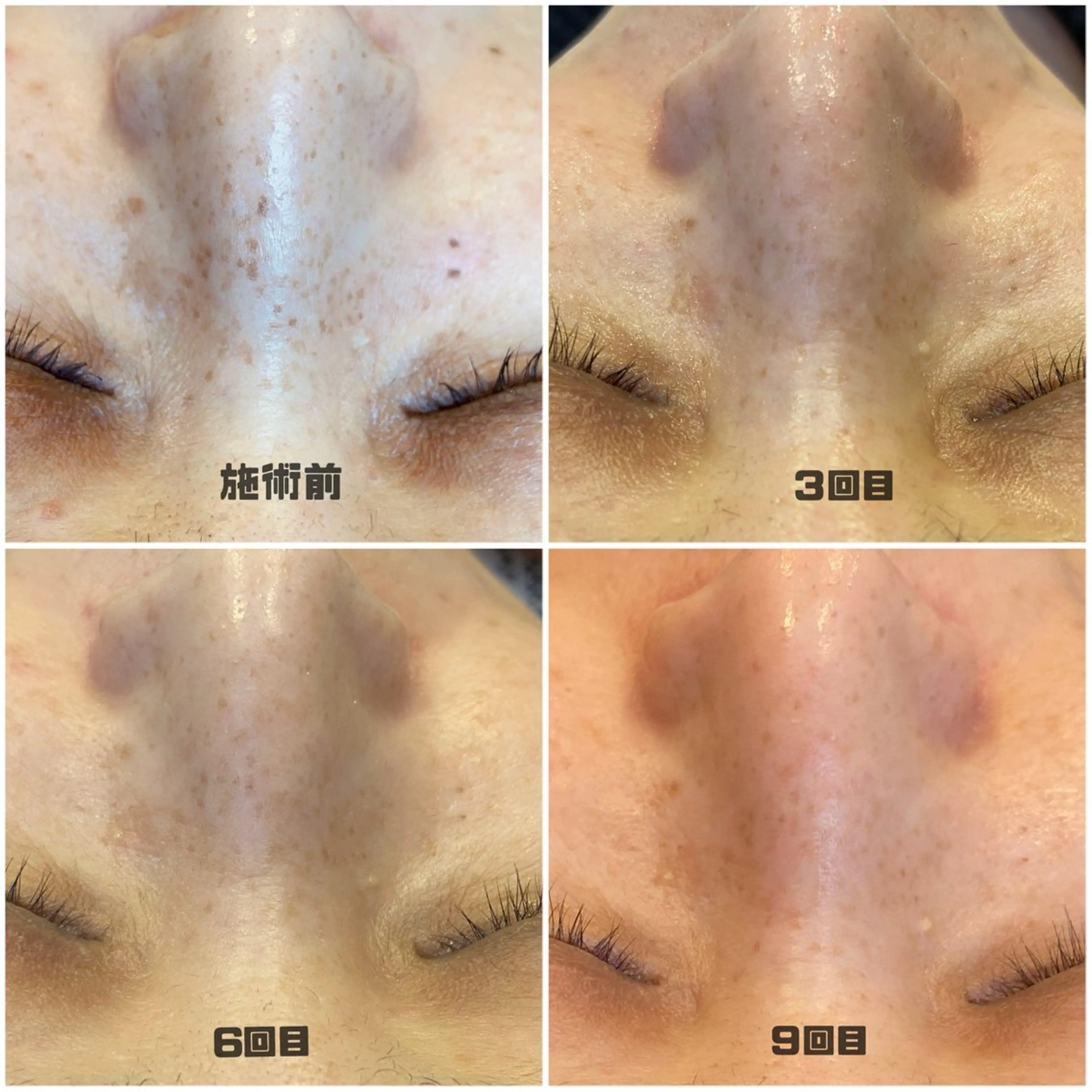 エステ D’accord Rikoのネイルデザイン