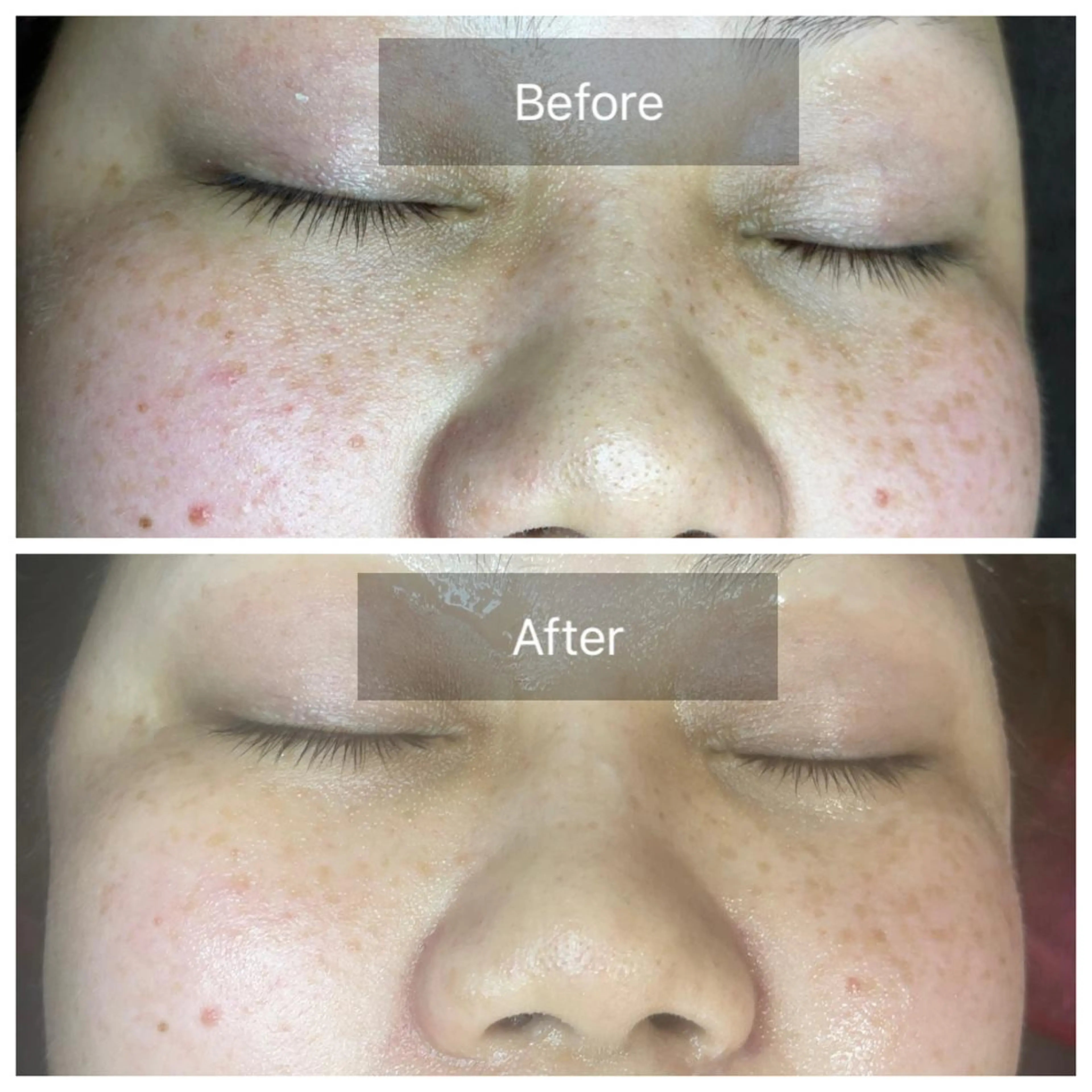 肌質改善サロン facialmoonのエステ・リラクイメージ