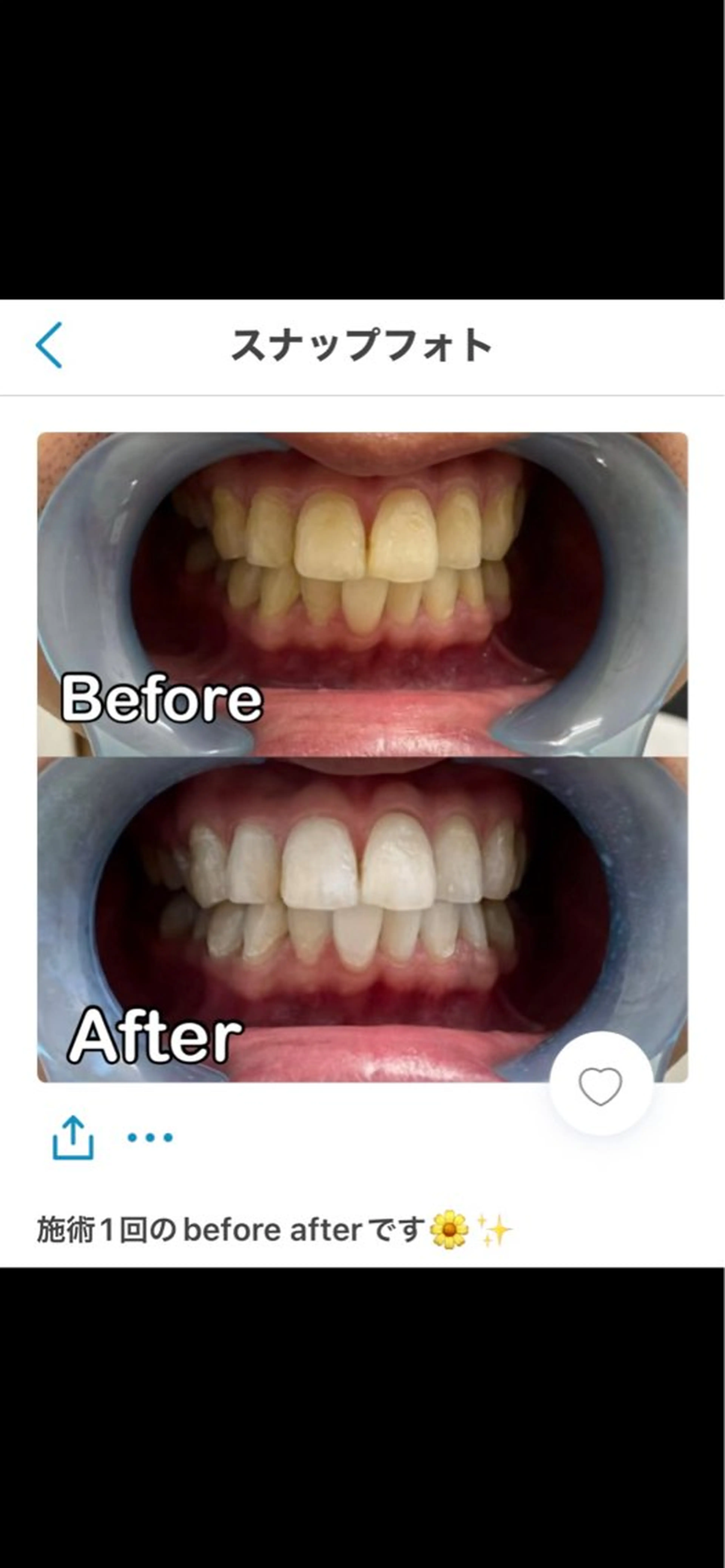 WHITENING ハウスのマツエク・マツパデザイン