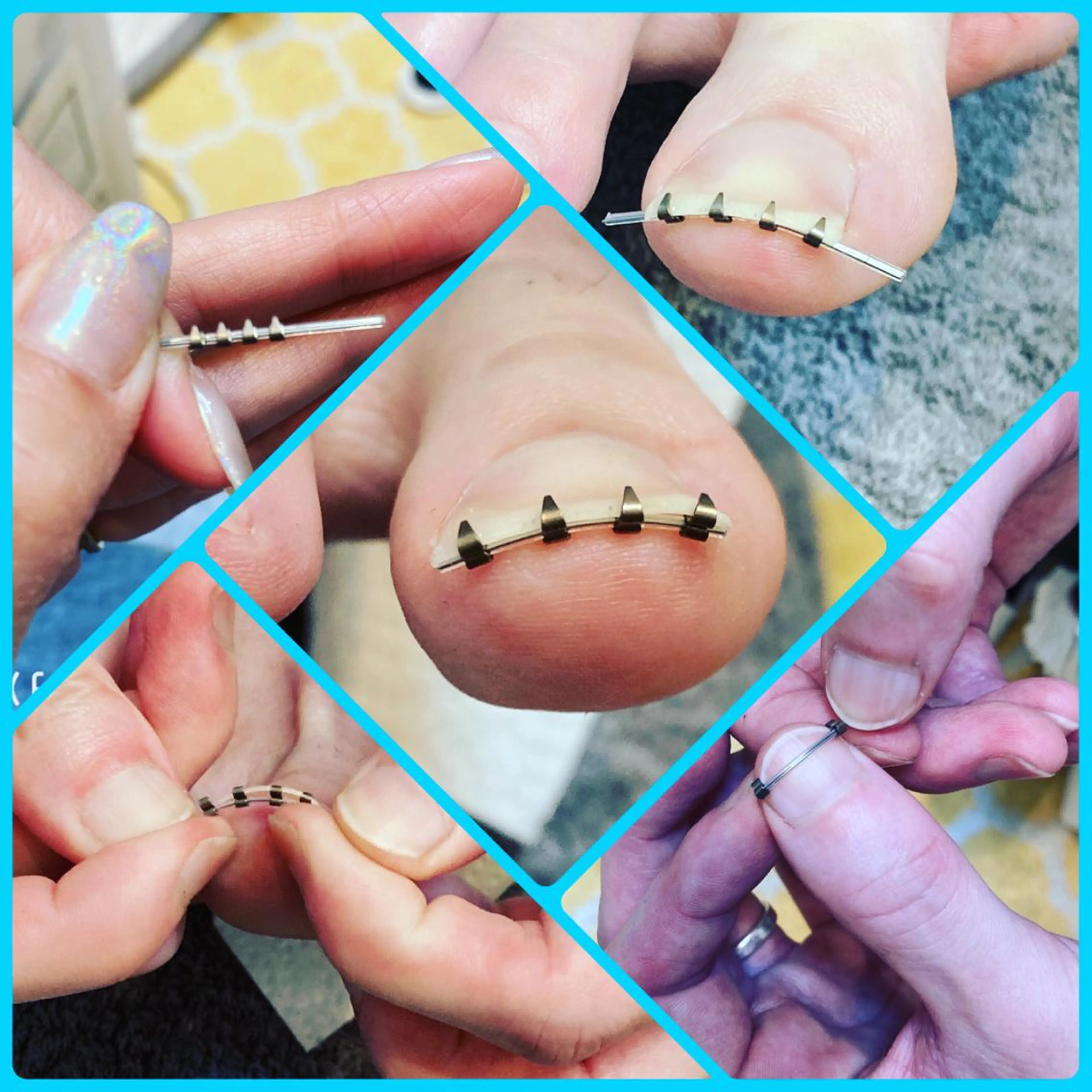 ネイル More ✴︎ （モアプラス）のエステ・リラクイメージ