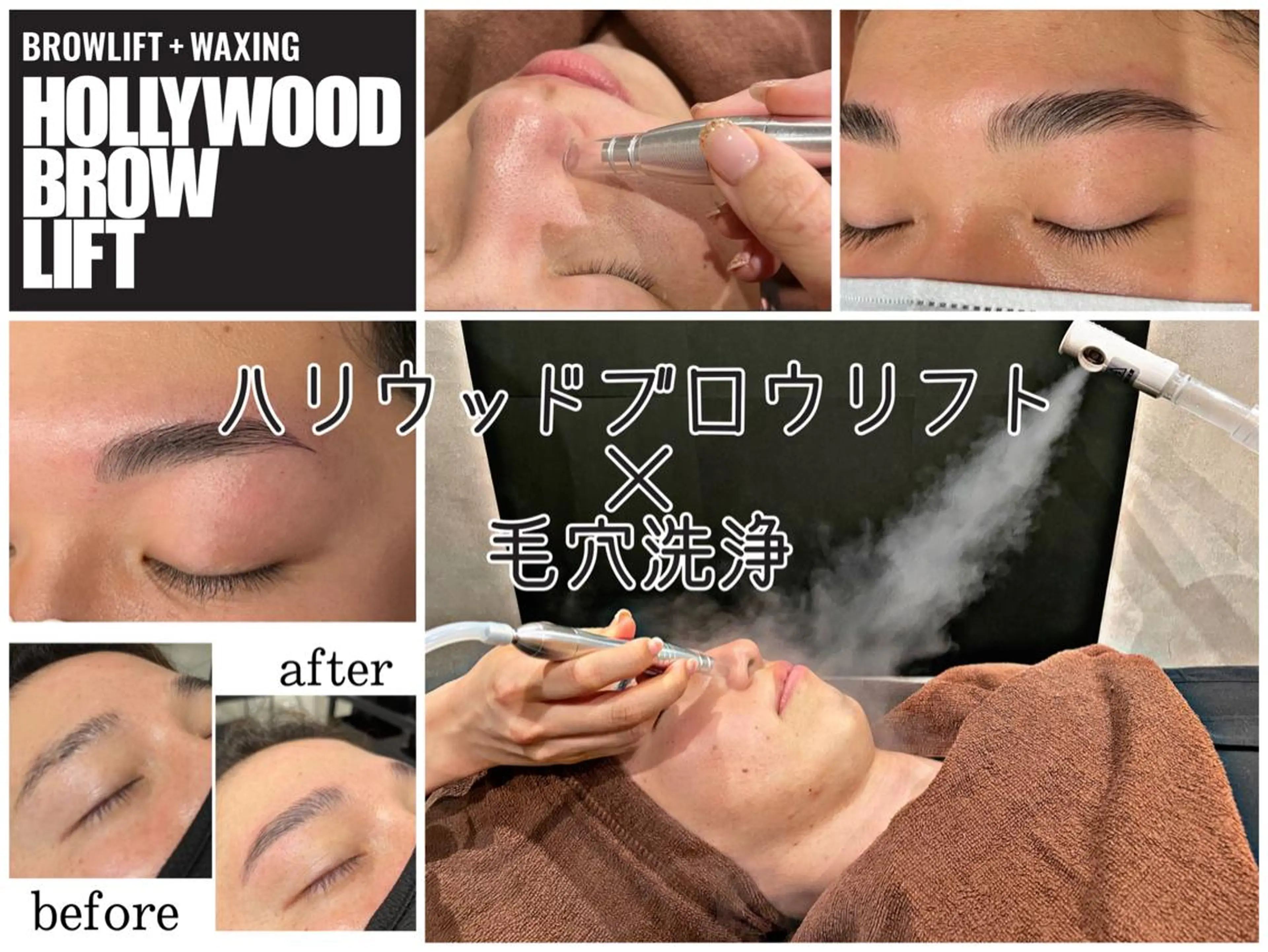 【メンズアイブロウ&フェイシャル】HBL×毛穴洗浄（炭酸クレンジング&潤いパック付き）の写真