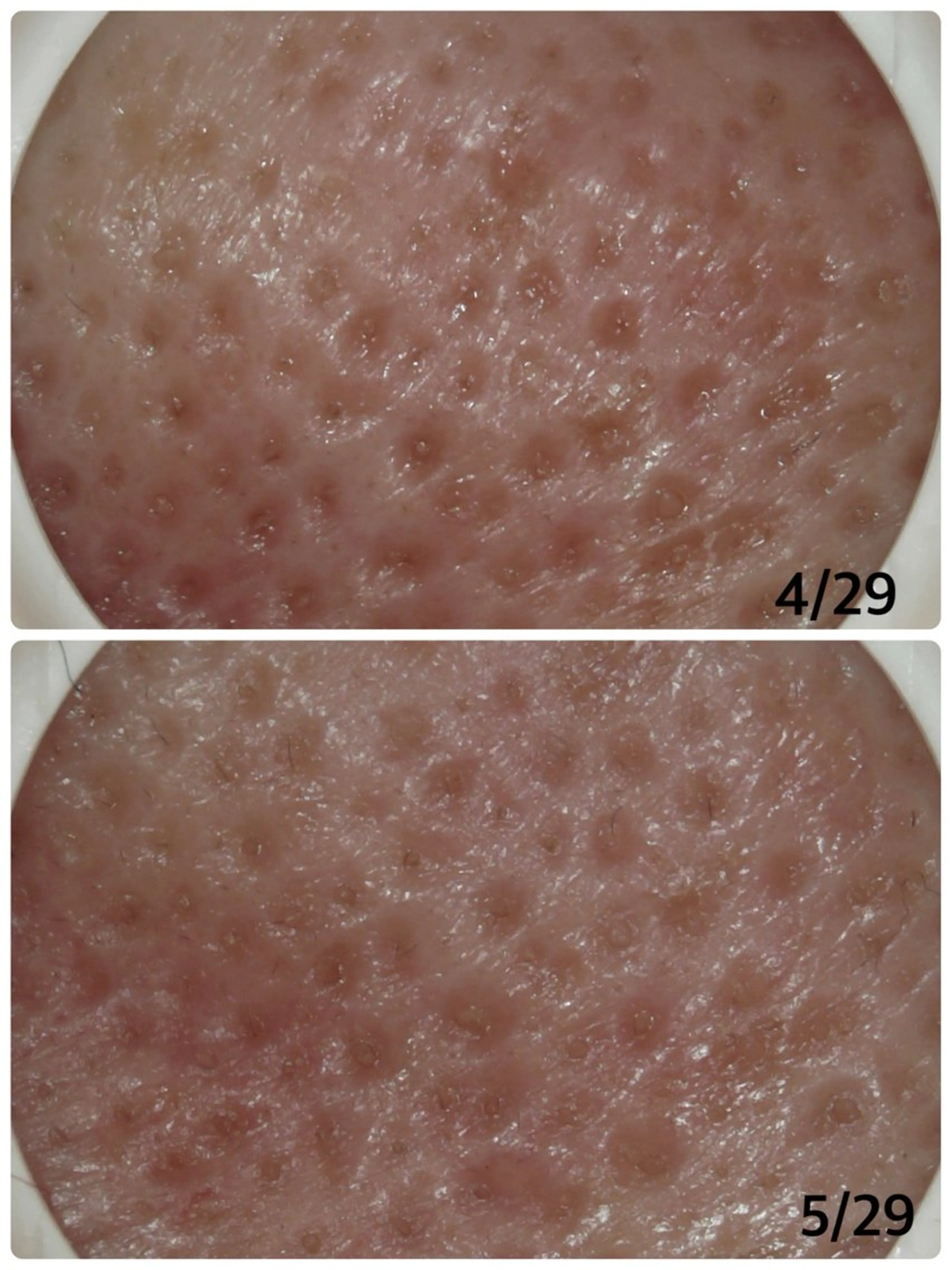 エステ リラク メナード片町 やまもと みくのエステ・リラクイメージ