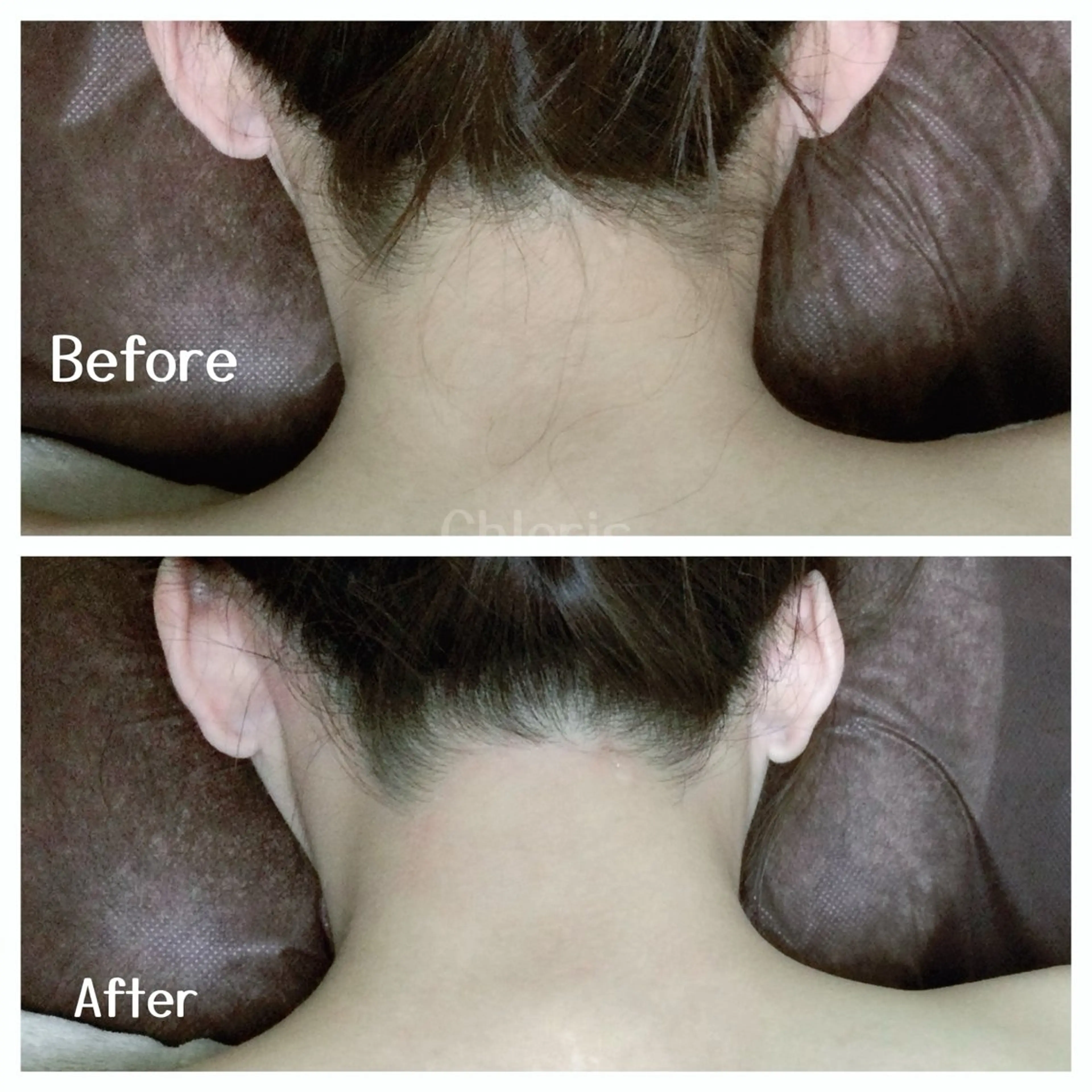 川越デリケートゾーン 光脱毛/ワックス脱毛のエステ・リラクイメージ