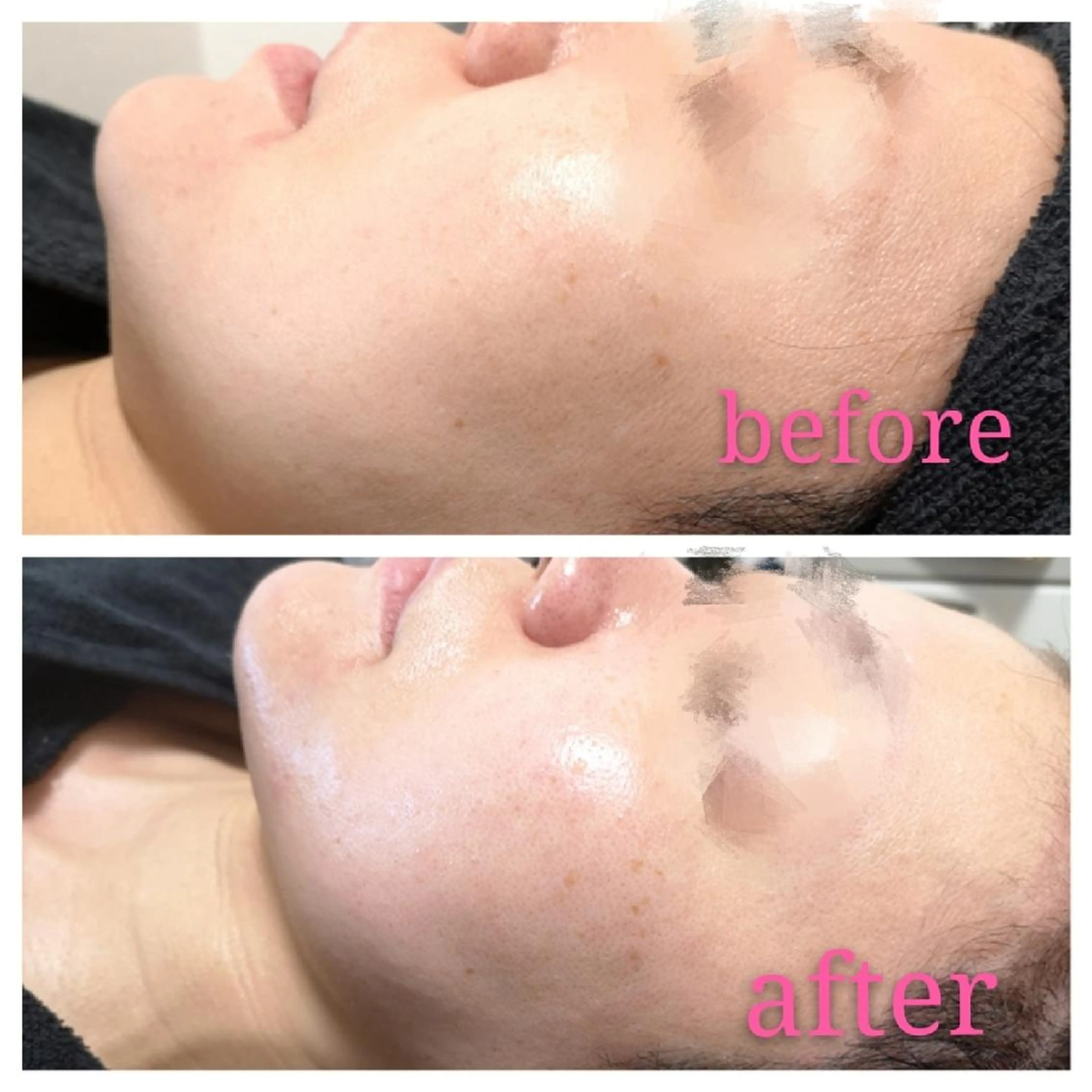 🅖🅤🅩🅔🅛 salonのエステ・リラクイメージ