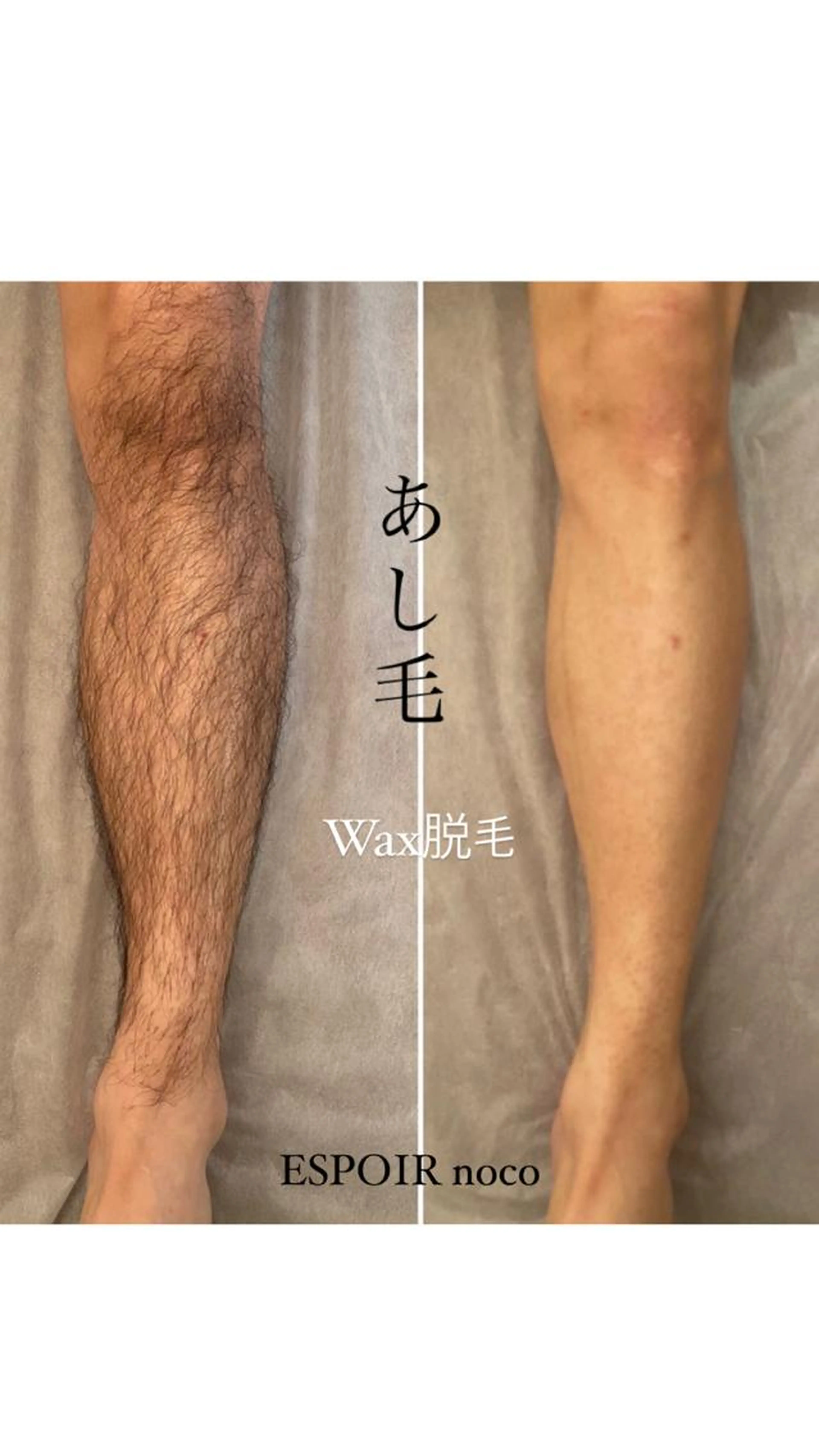 【メンズ限定】脚Wax脱毛🦵通常¥14,300→¥13,000🌈ハーパンでツルツル美脚の写真