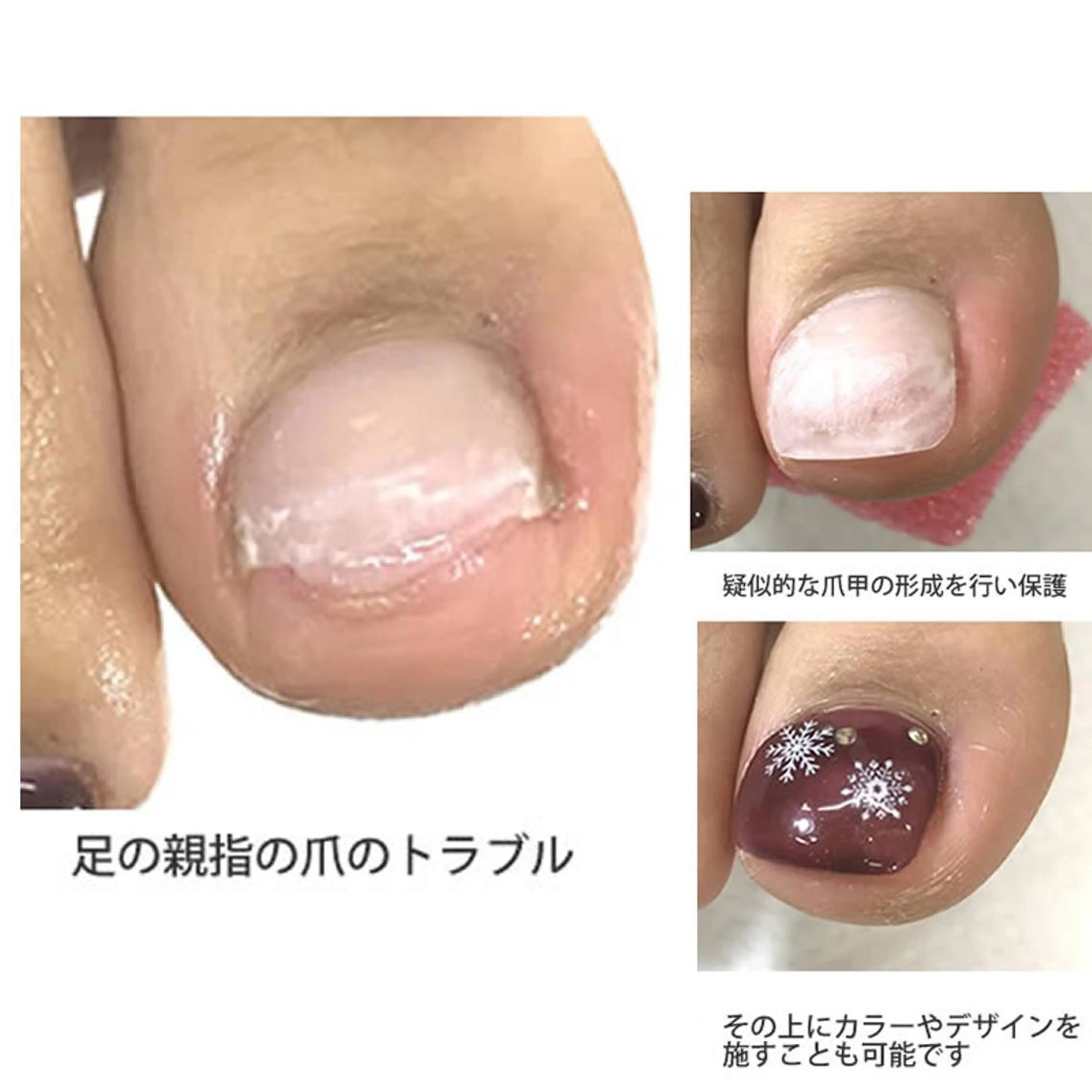 ネイル イワサキ  のネイルデザイン