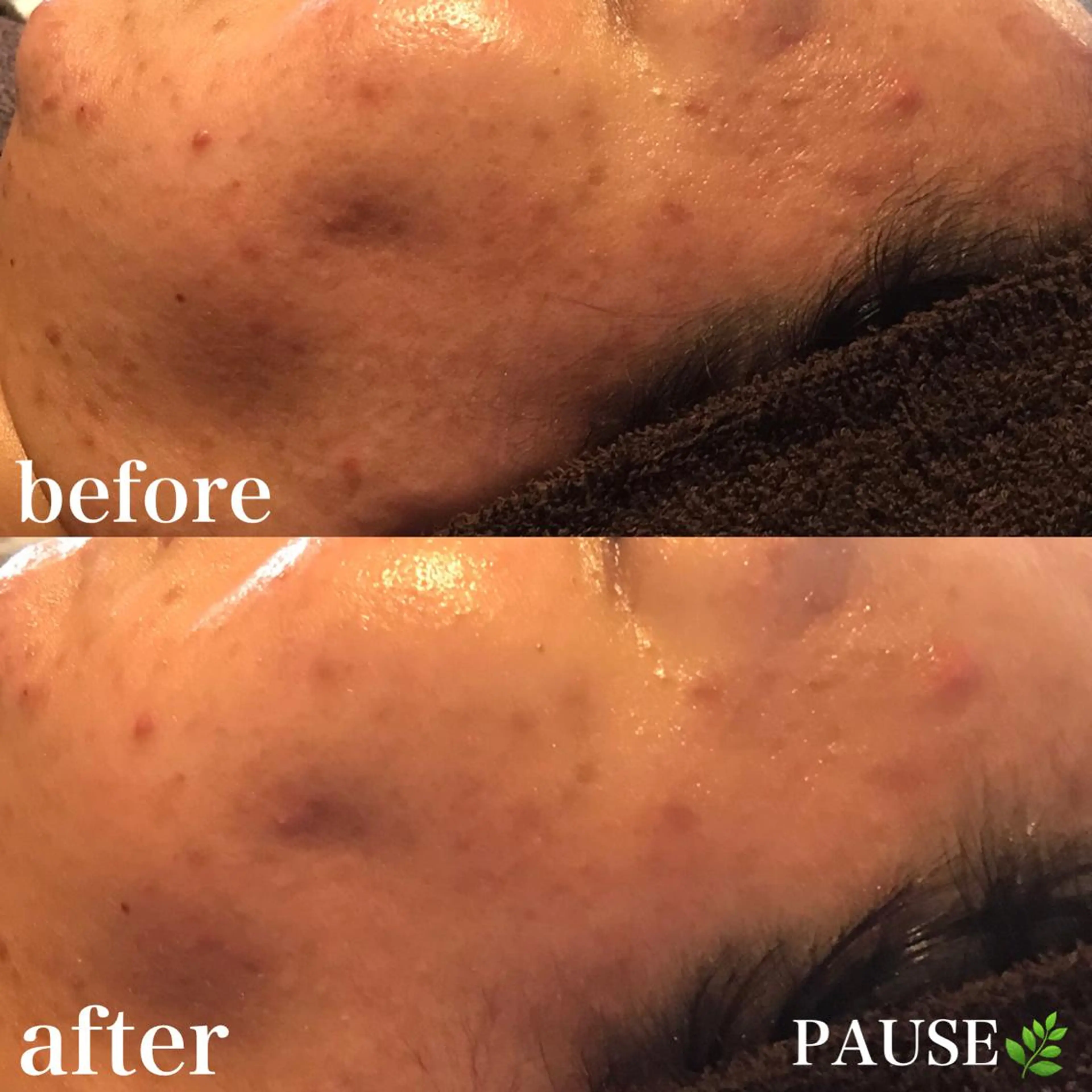 エステ 浜野 恵美のエステ・リラクイメージ