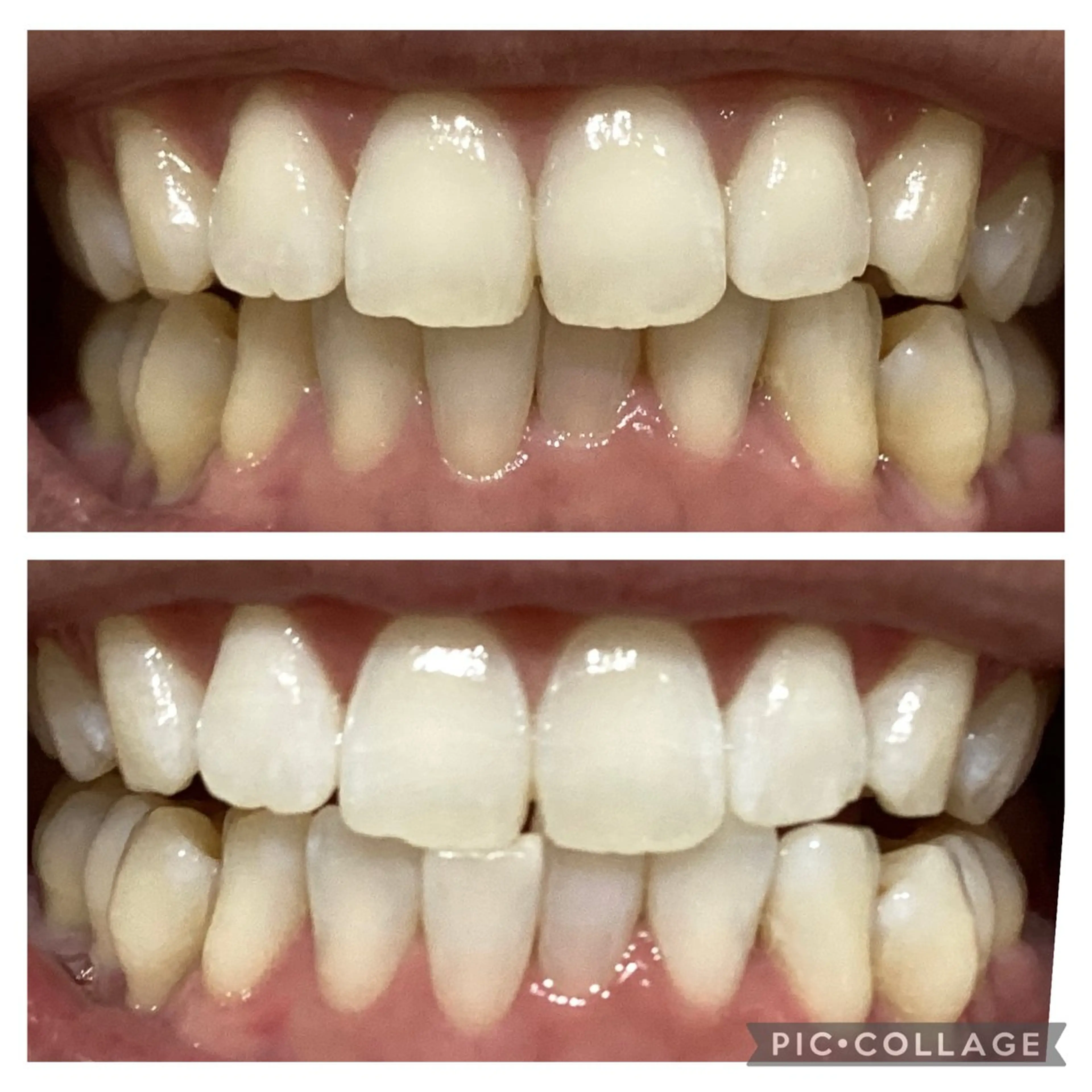 セルフホワイトニングサロン　Betee所属・セルフホワイトニング Beteeのエステ・リラクイメージ