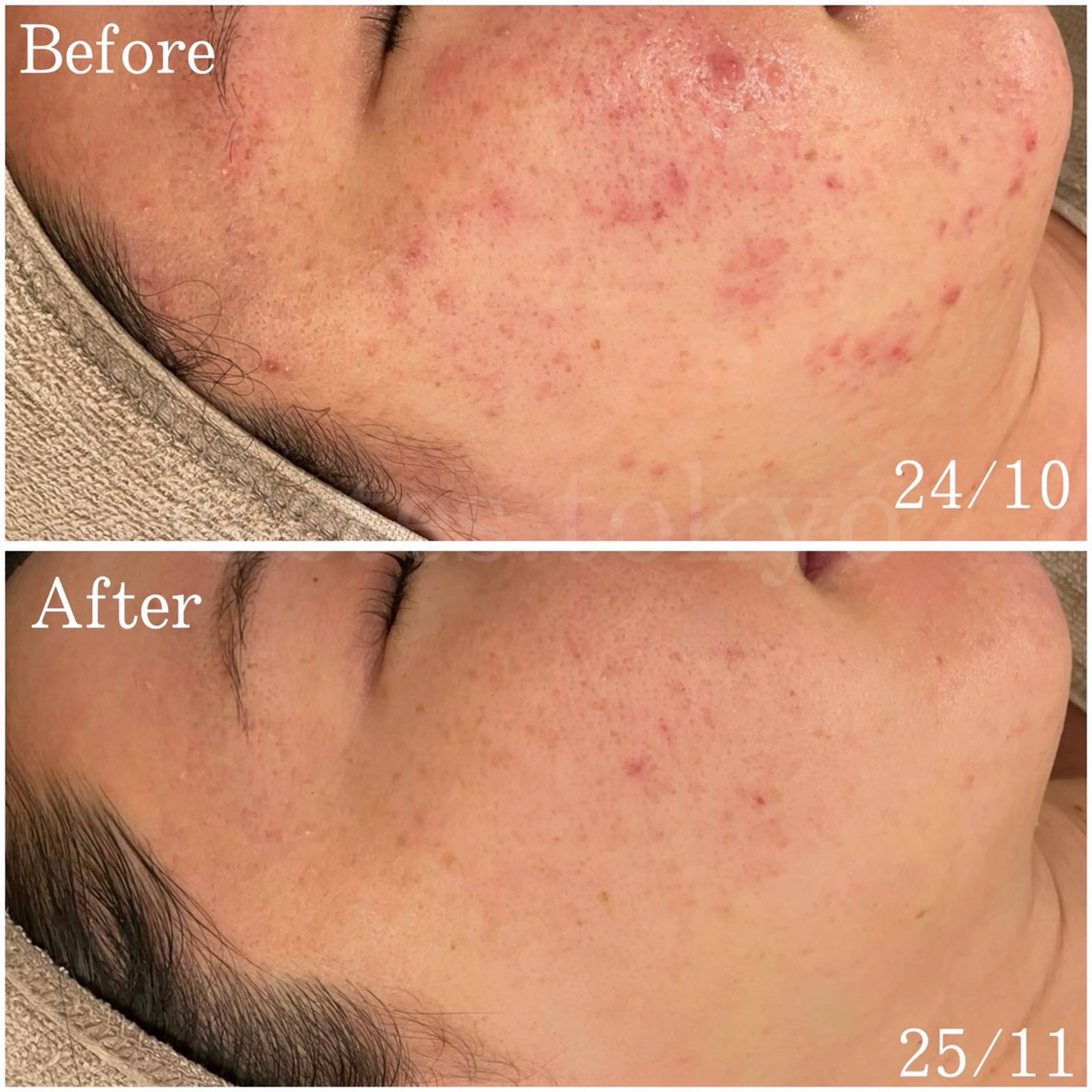 etes.tokyo 中目黒のエステ・リラクイメージ