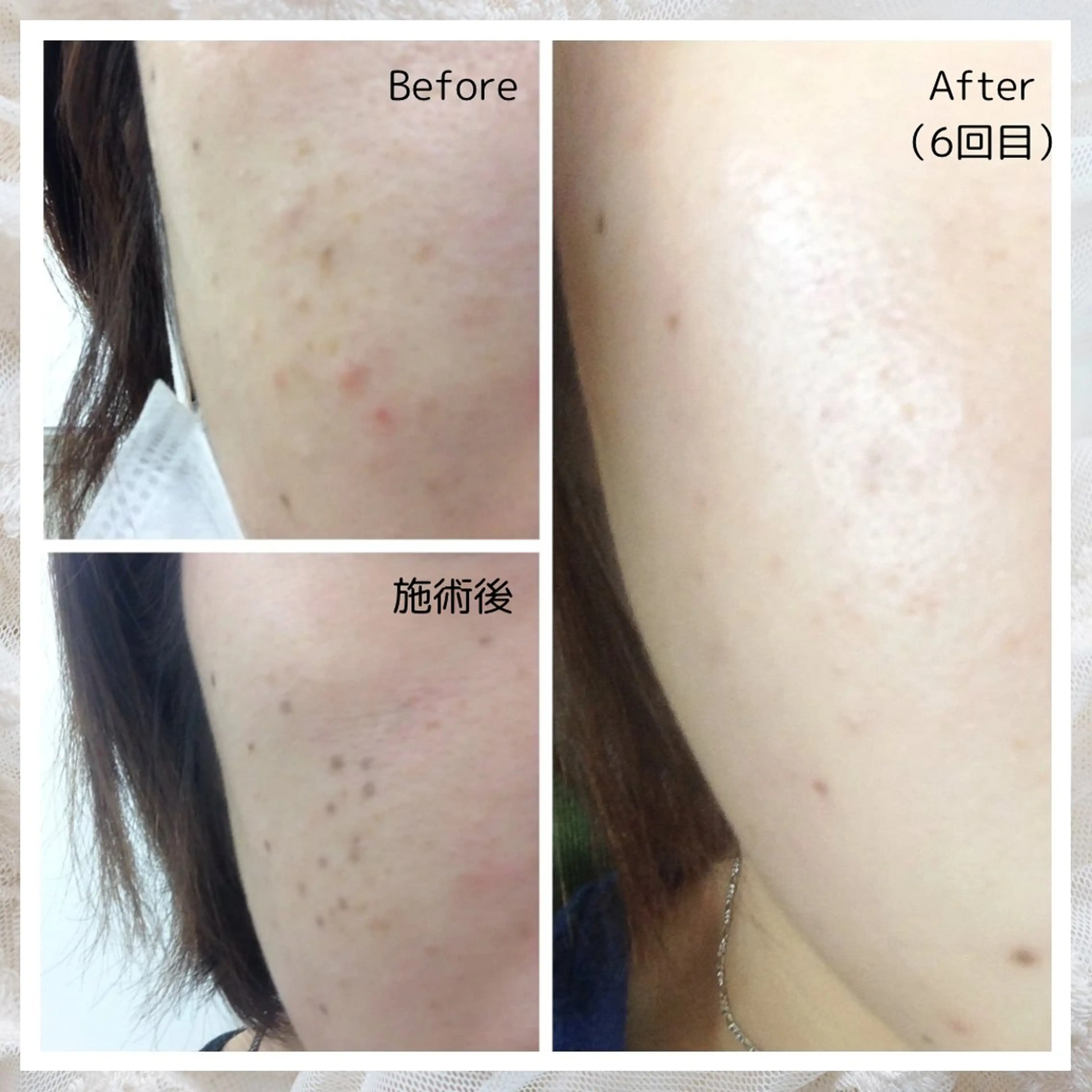 シミケア・肌育サロン Jullyのエステ・リラクイメージ